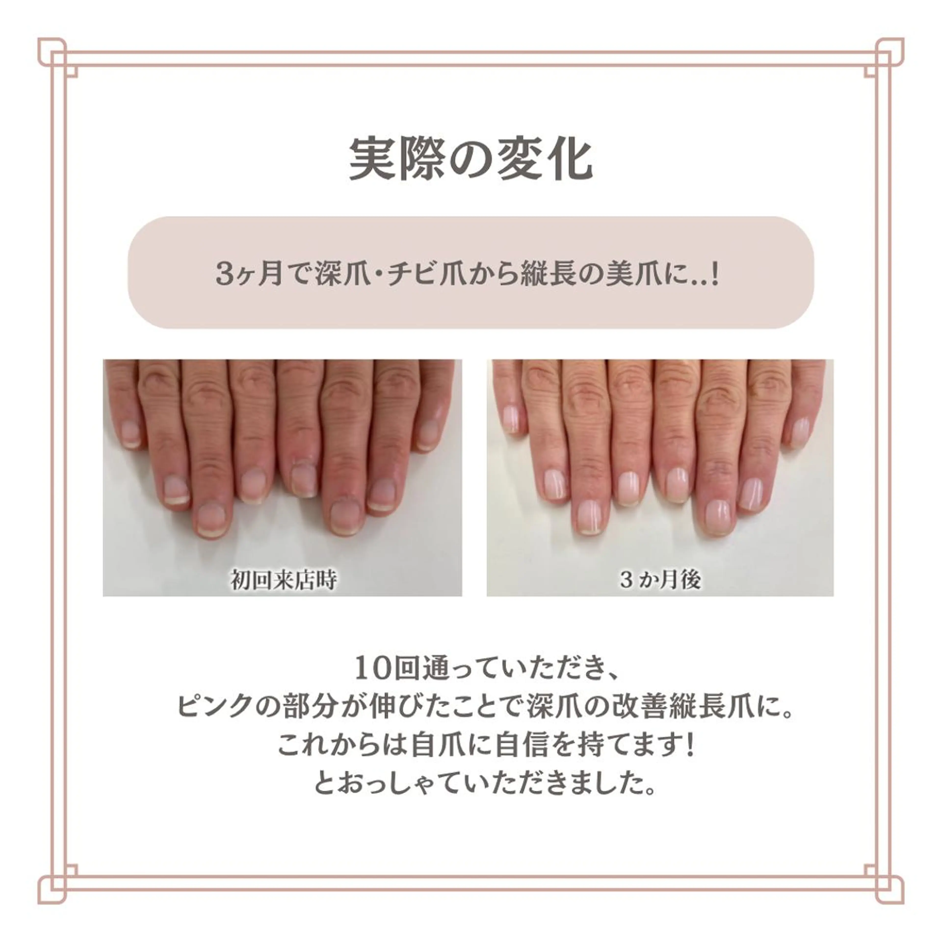 ネイル 自爪育成専門サロン エムロードゥ池下のネイルデザイン