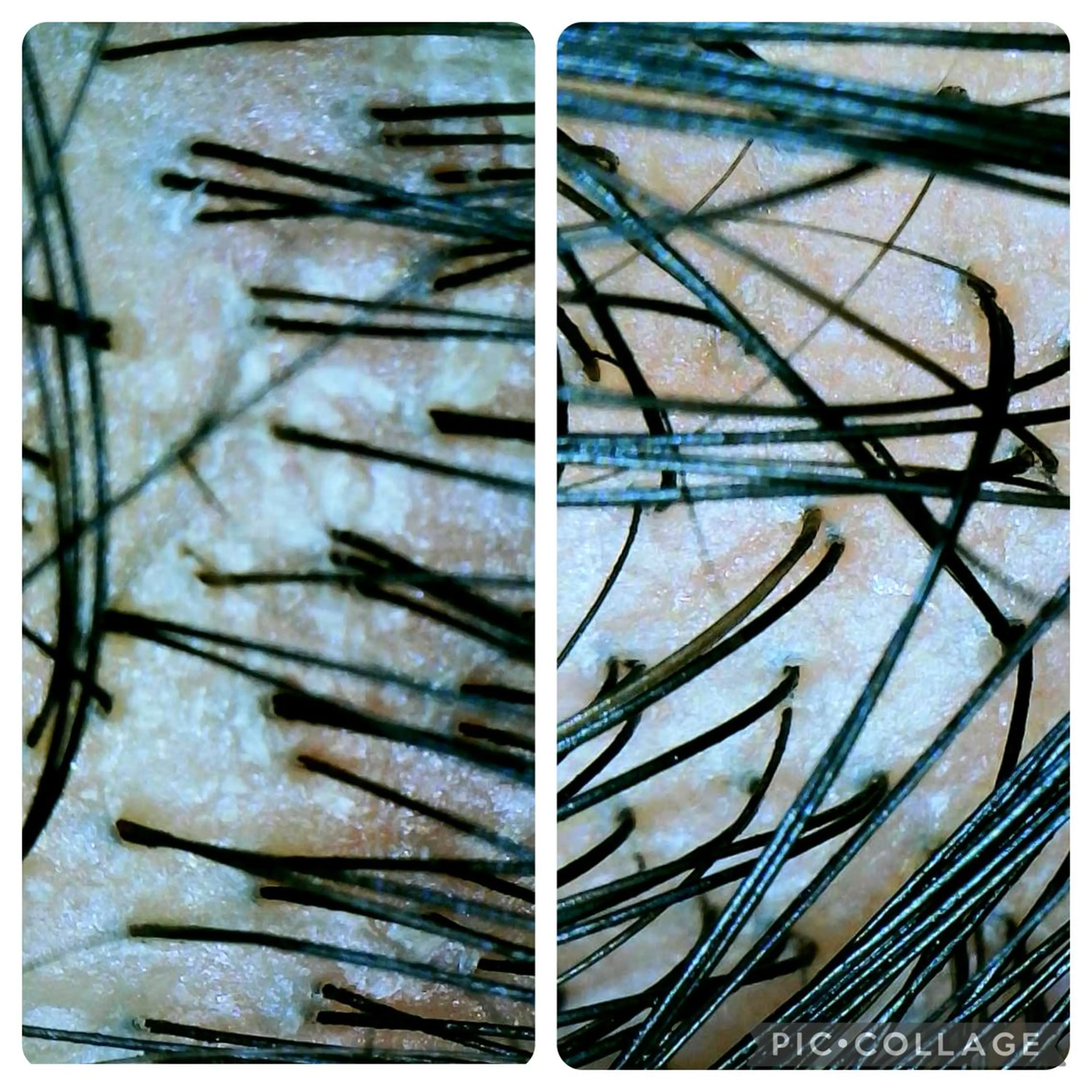 🅖🅤🅩🅔🅛 salonのエステ・リラクイメージ