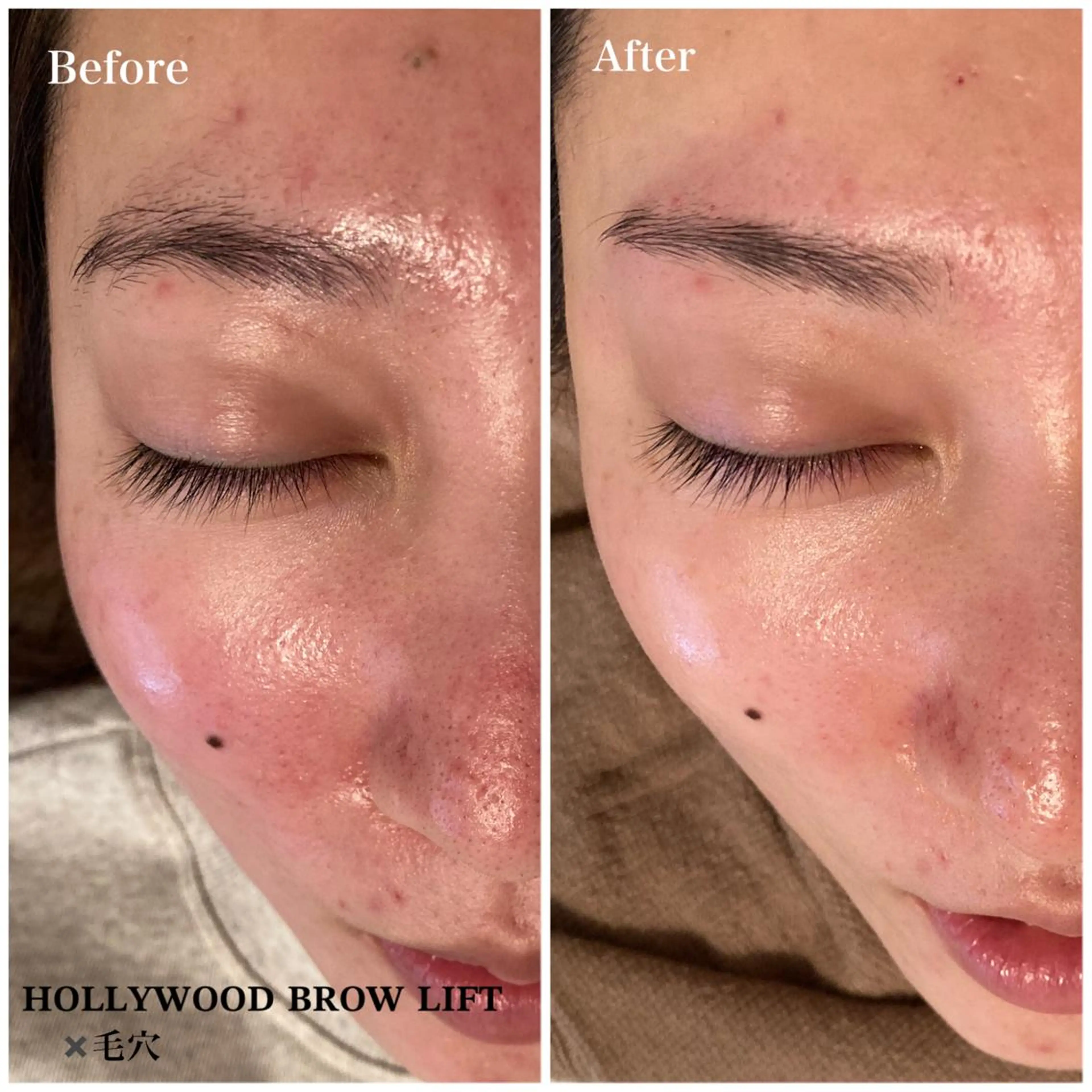 アイブロウ Ｂ&H所属・頭痛肩こり改善/小顔 サロンB&H心斎橋のエステ・リラクイメージ