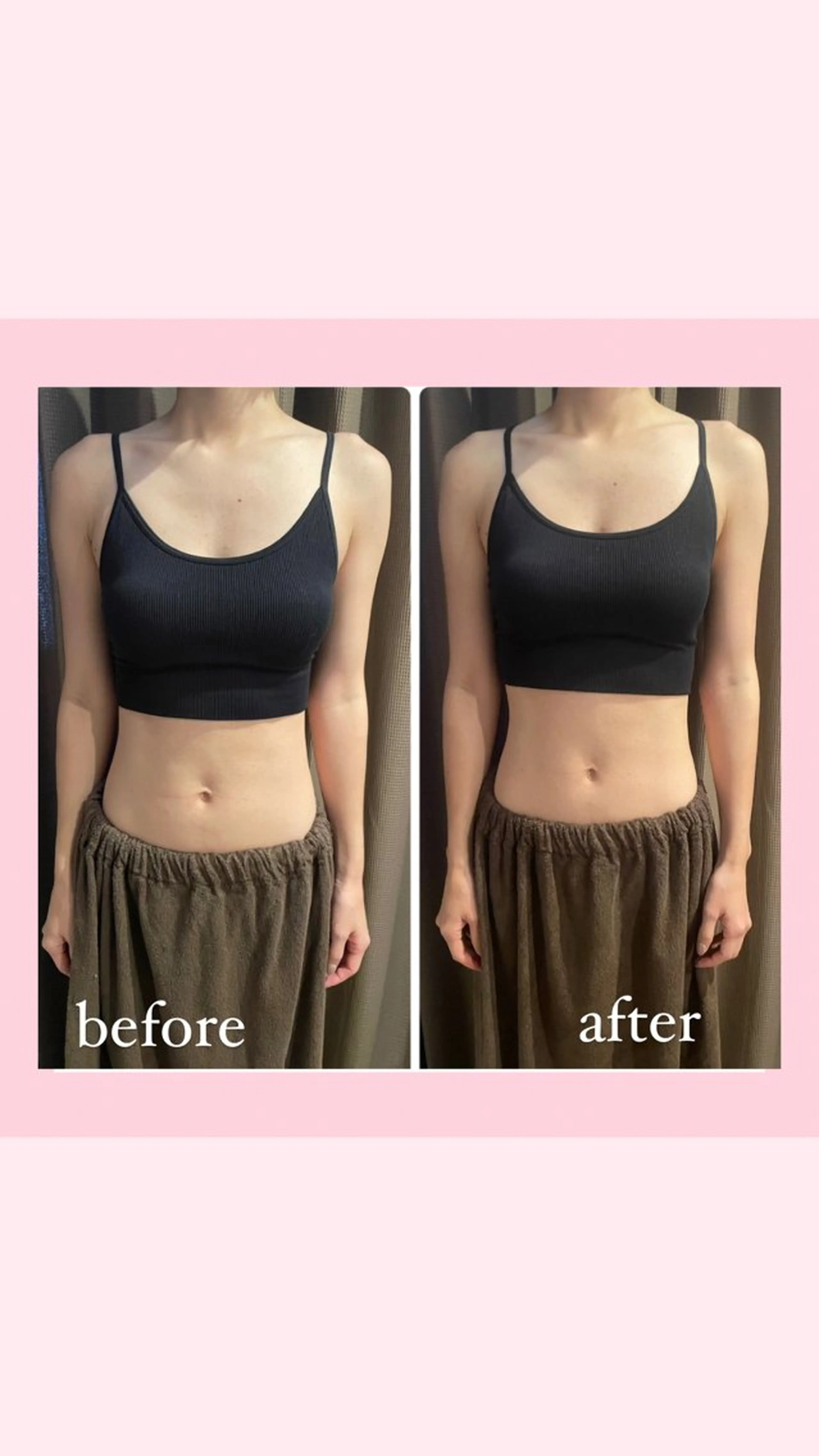 美人スイッチdiet スーパージェクションのその他イメージ