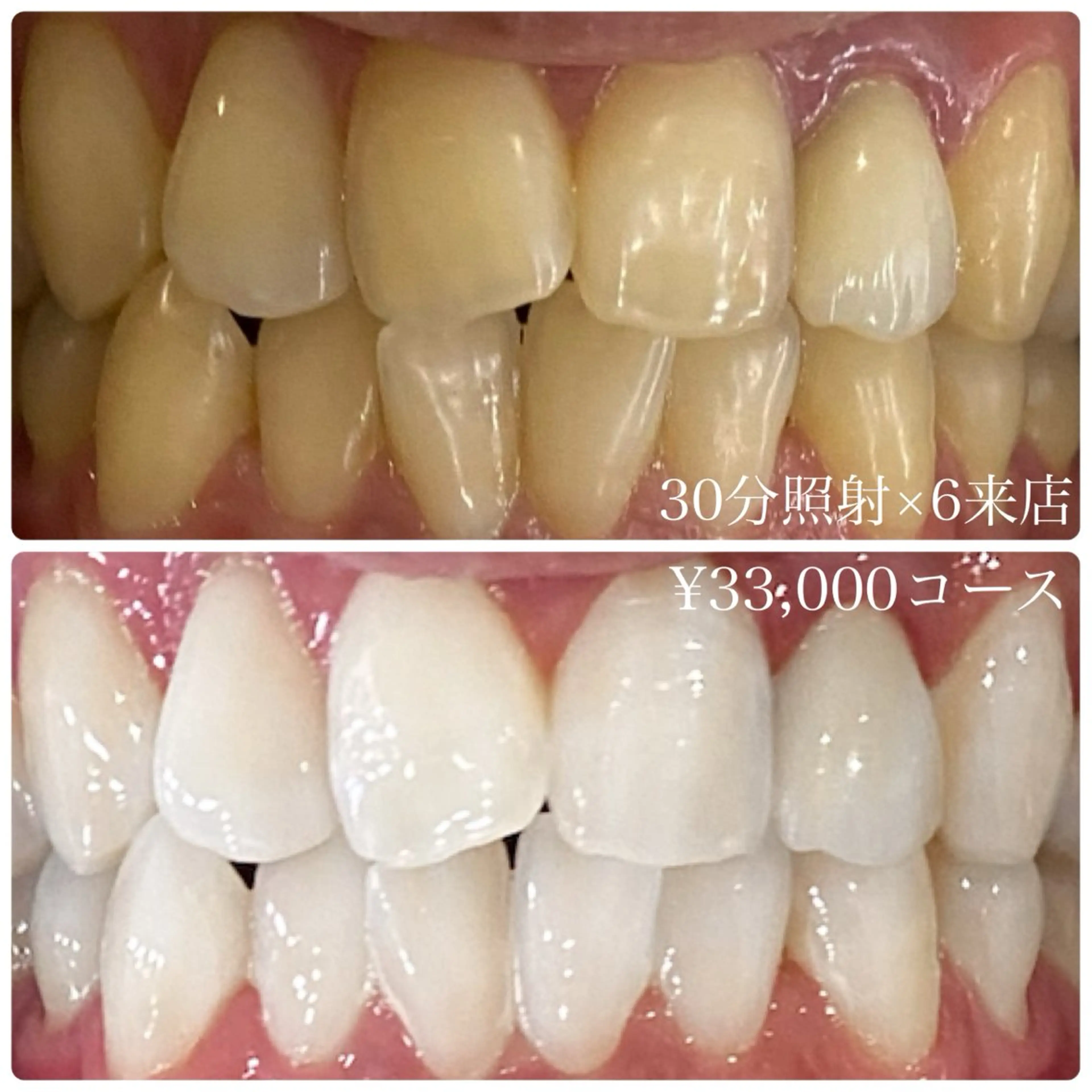 メンズ ホワイトニング ルーム　川崎店のその他イメージ