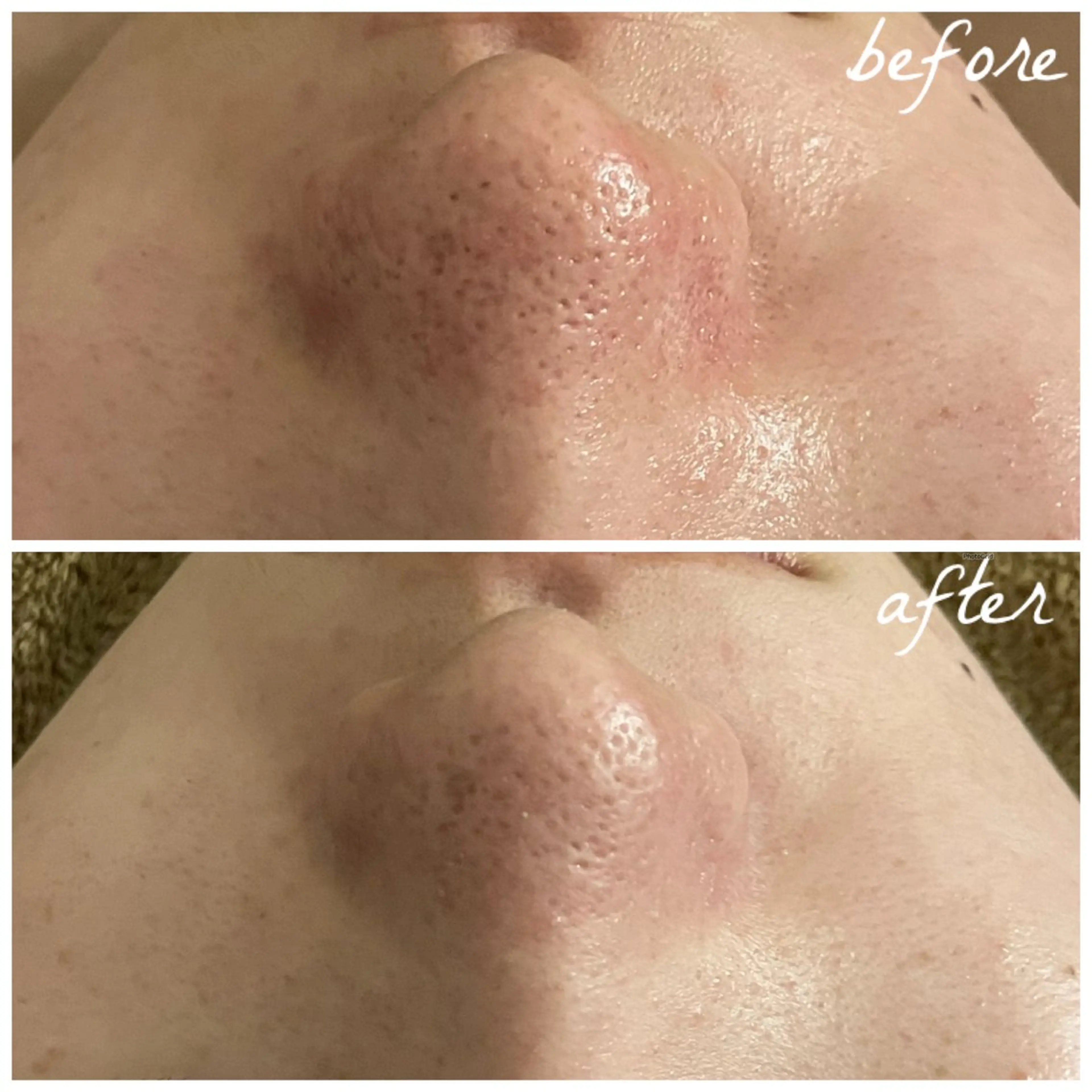 メンズ エステ メナード岐阜市茜部 杉浦のエステ・リラクイメージ