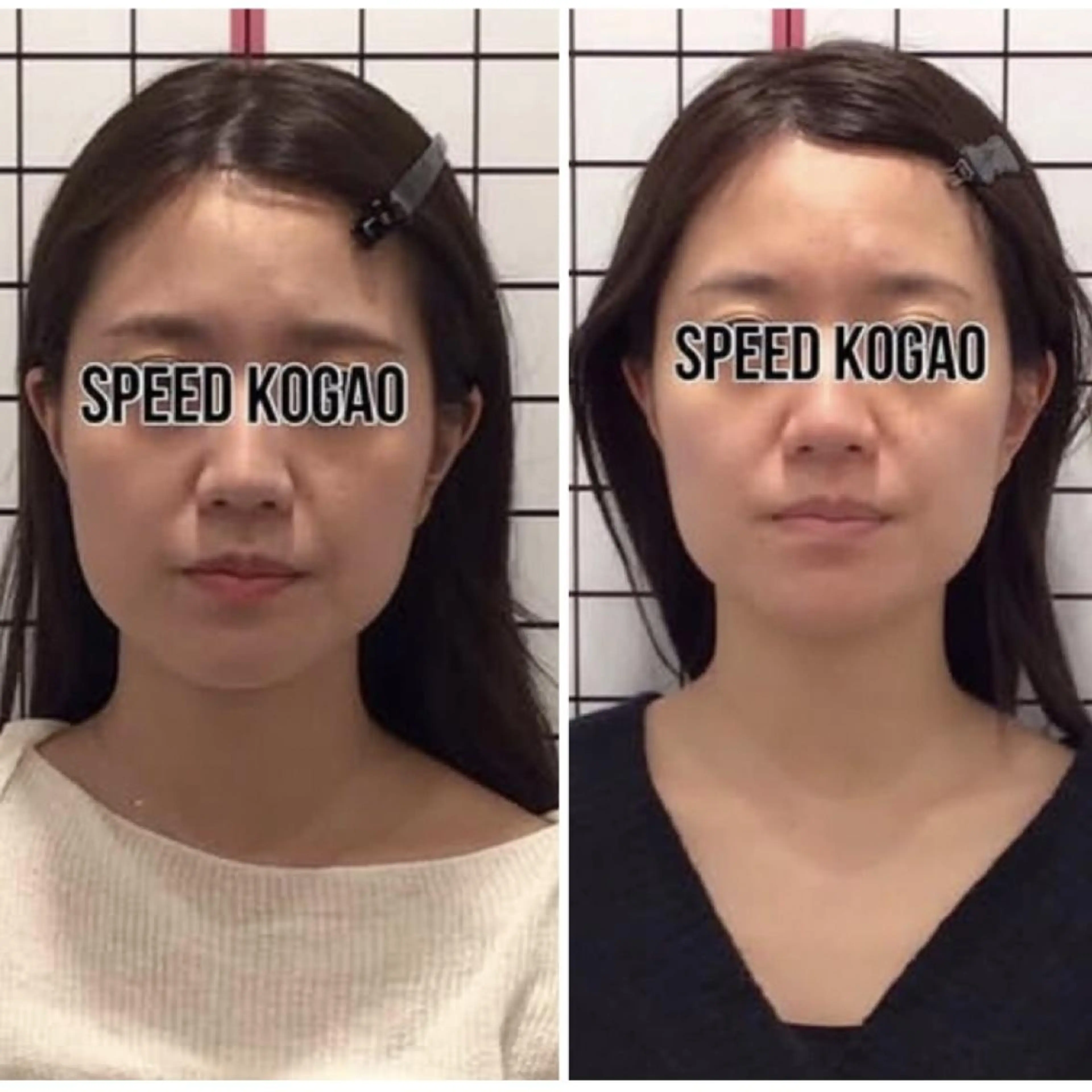 小顔矯正 natsuのエステ・リラクイメージ