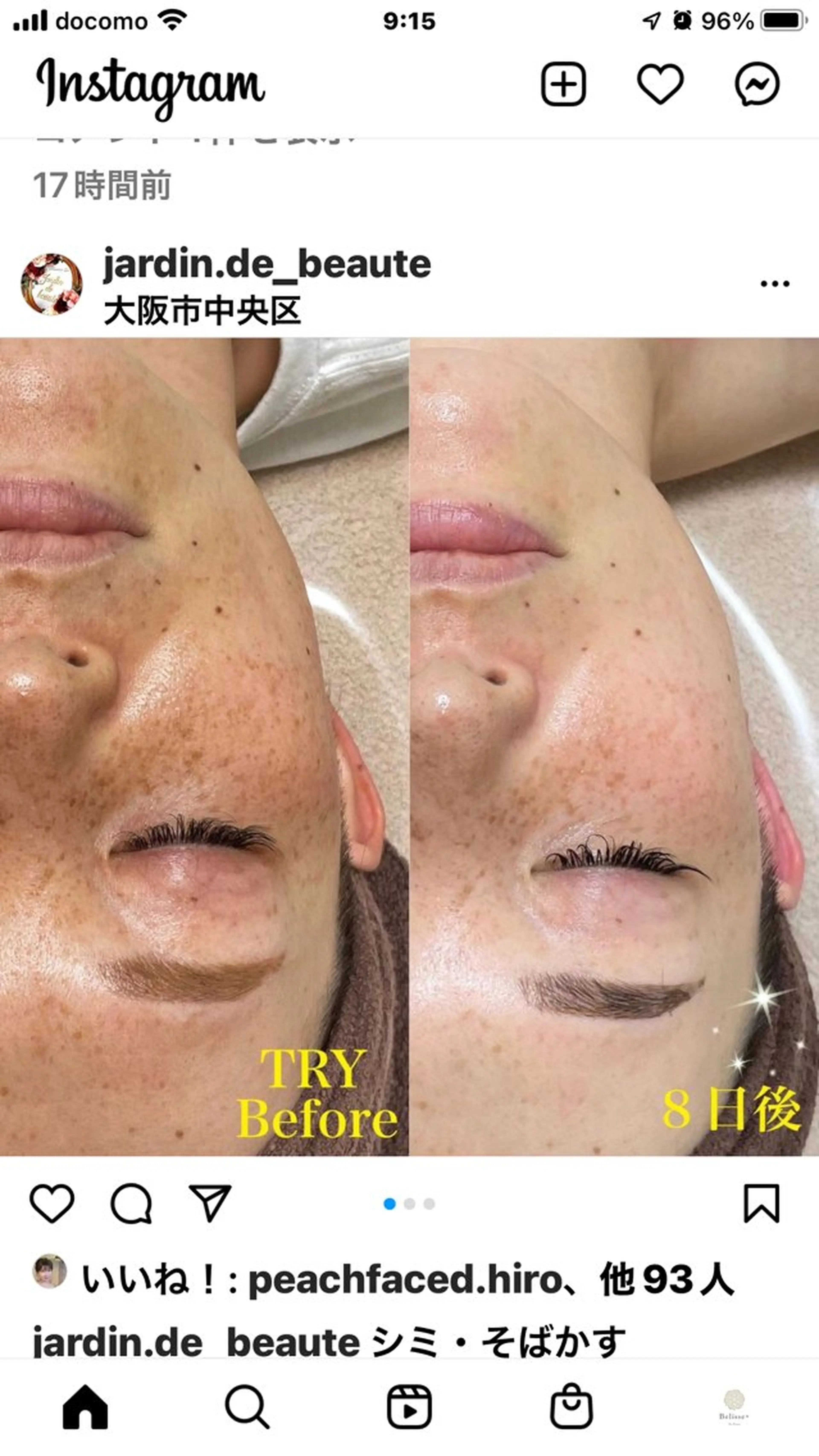 Belisse+ ベリッセプラスのエステ・リラクイメージ