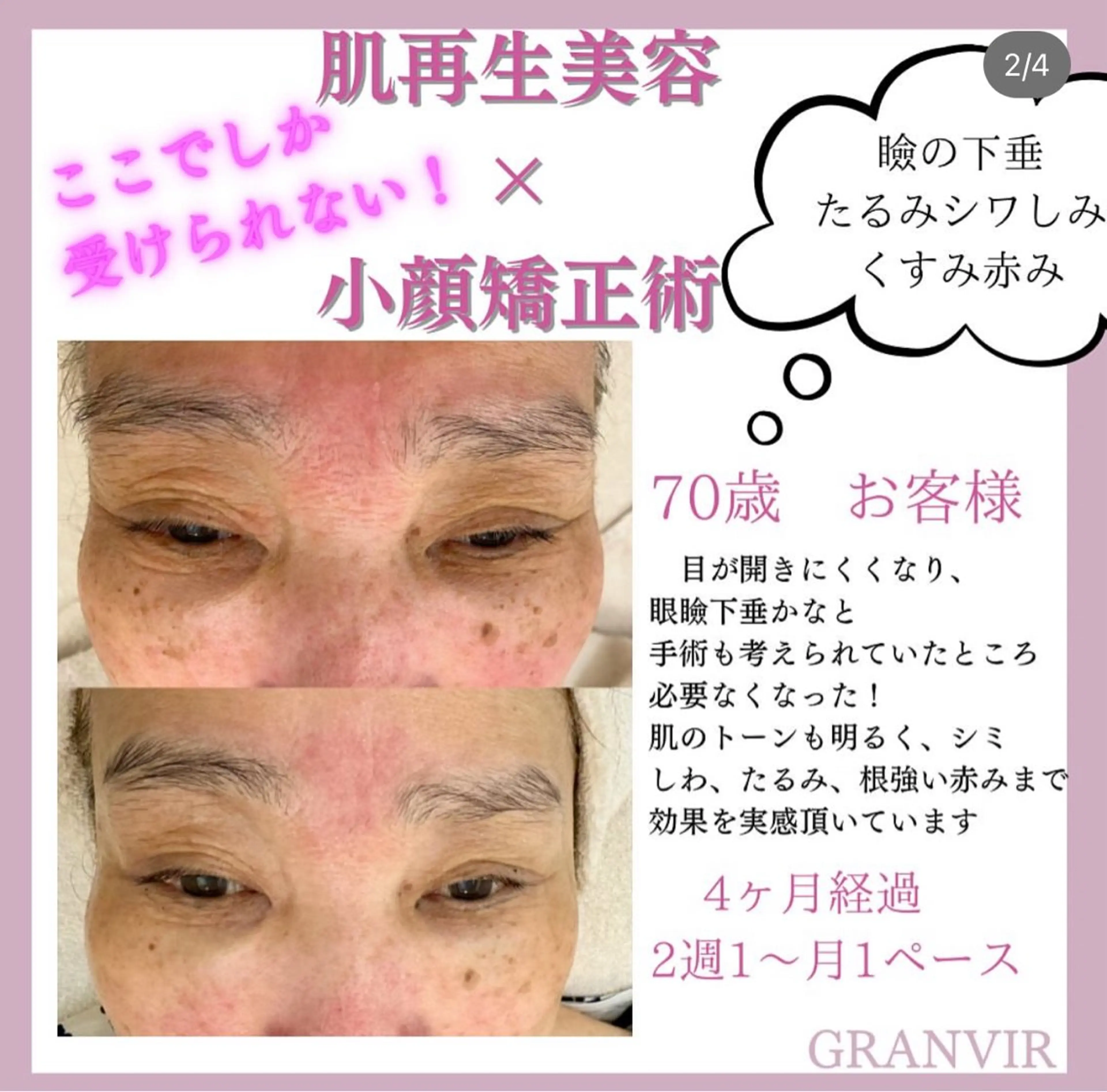 【福岡市西区 エステ】 GRANVIR(グランヴィール)所属・GRANVIR グランヴィールのエステ・リラクイメージ