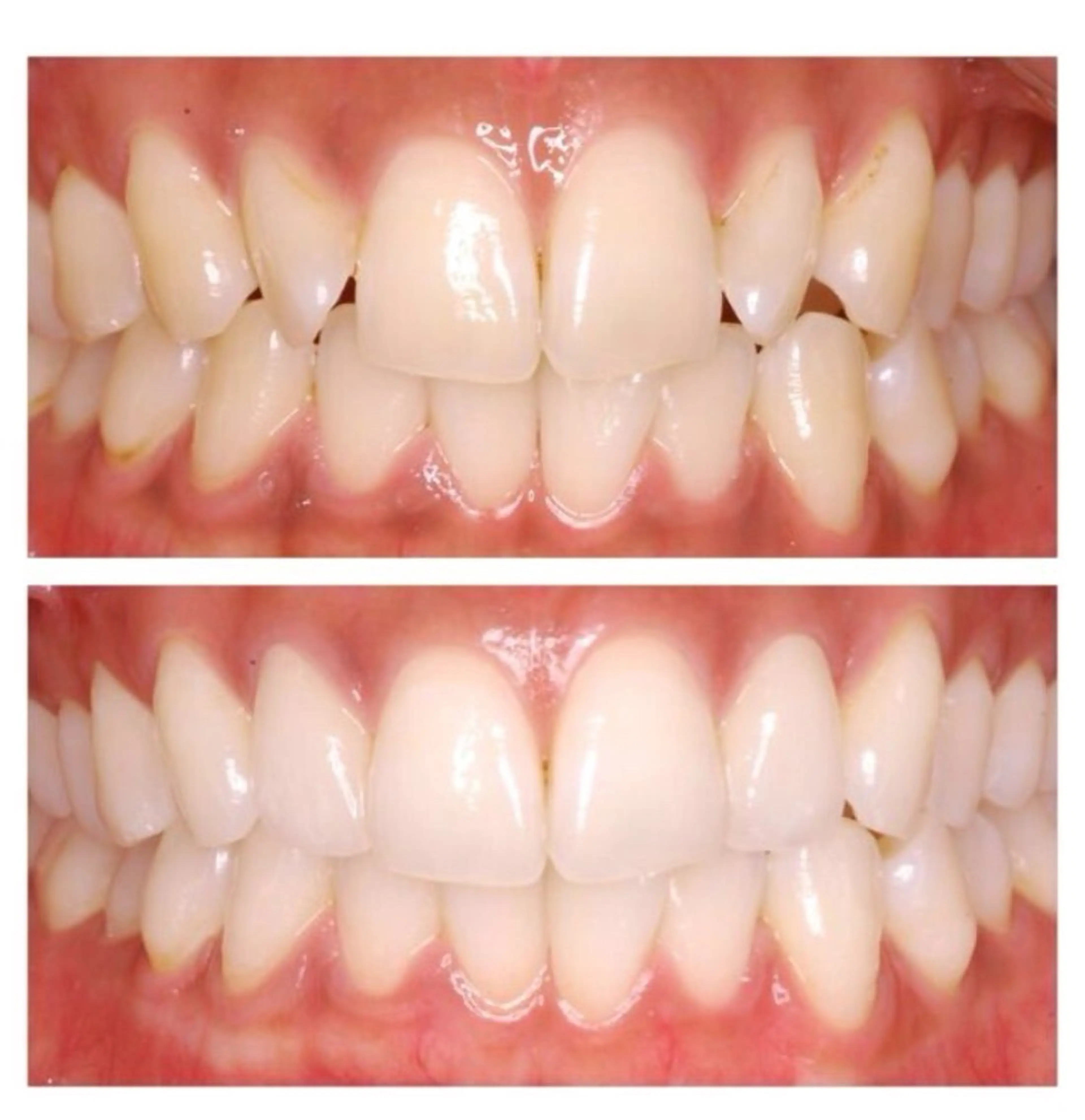 その他 ブリリエット 文山のエステ・リラクイメージ