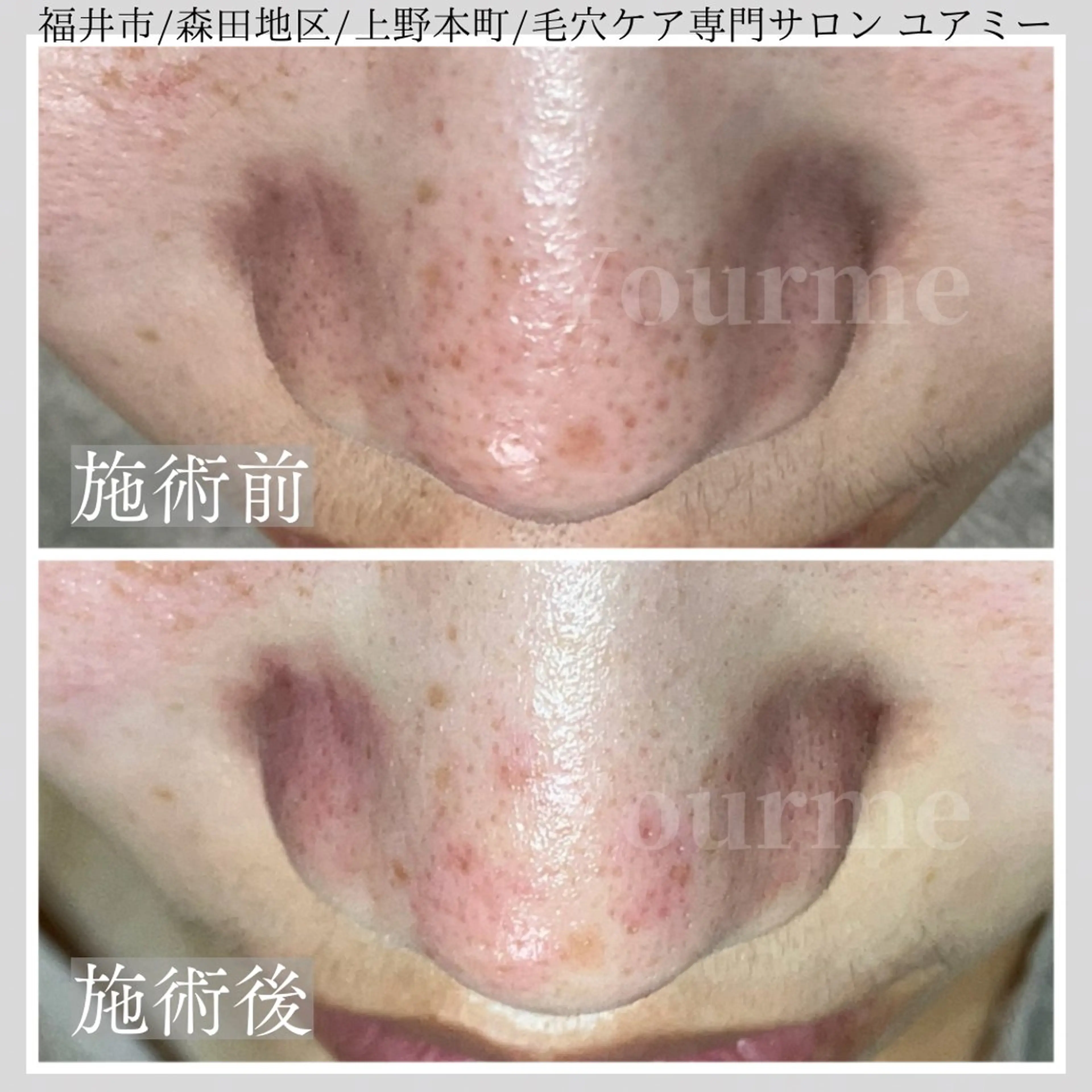 毛穴肌質ケアサロン Yourmeユアミーのエステ・リラクイメージ