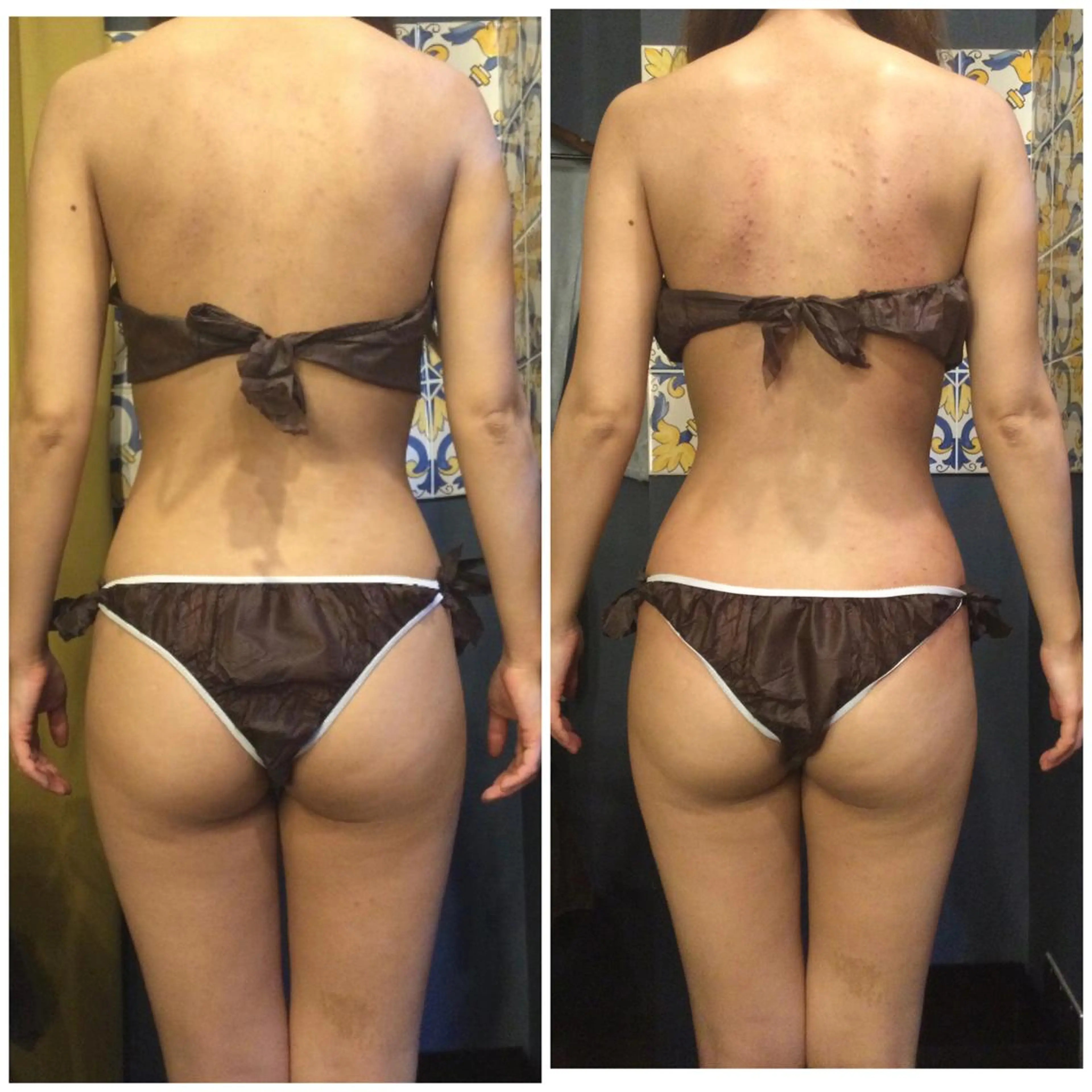 その他 小顔やたるみに特化 💚野瀬可蓮のその他イメージ