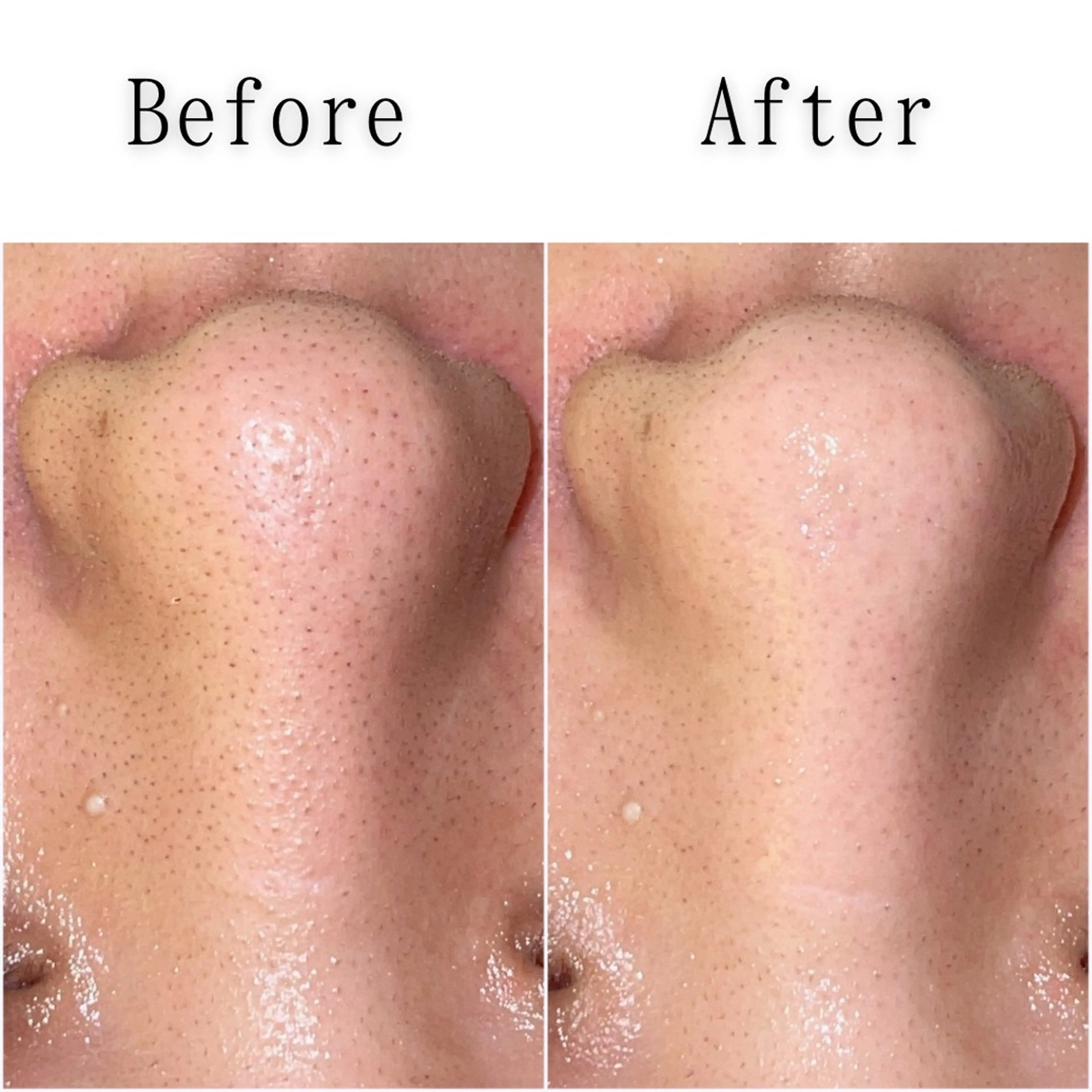 エステ SELF  BEAUTY gracia浦添店所属・gracia 浦添店のその他イメージ