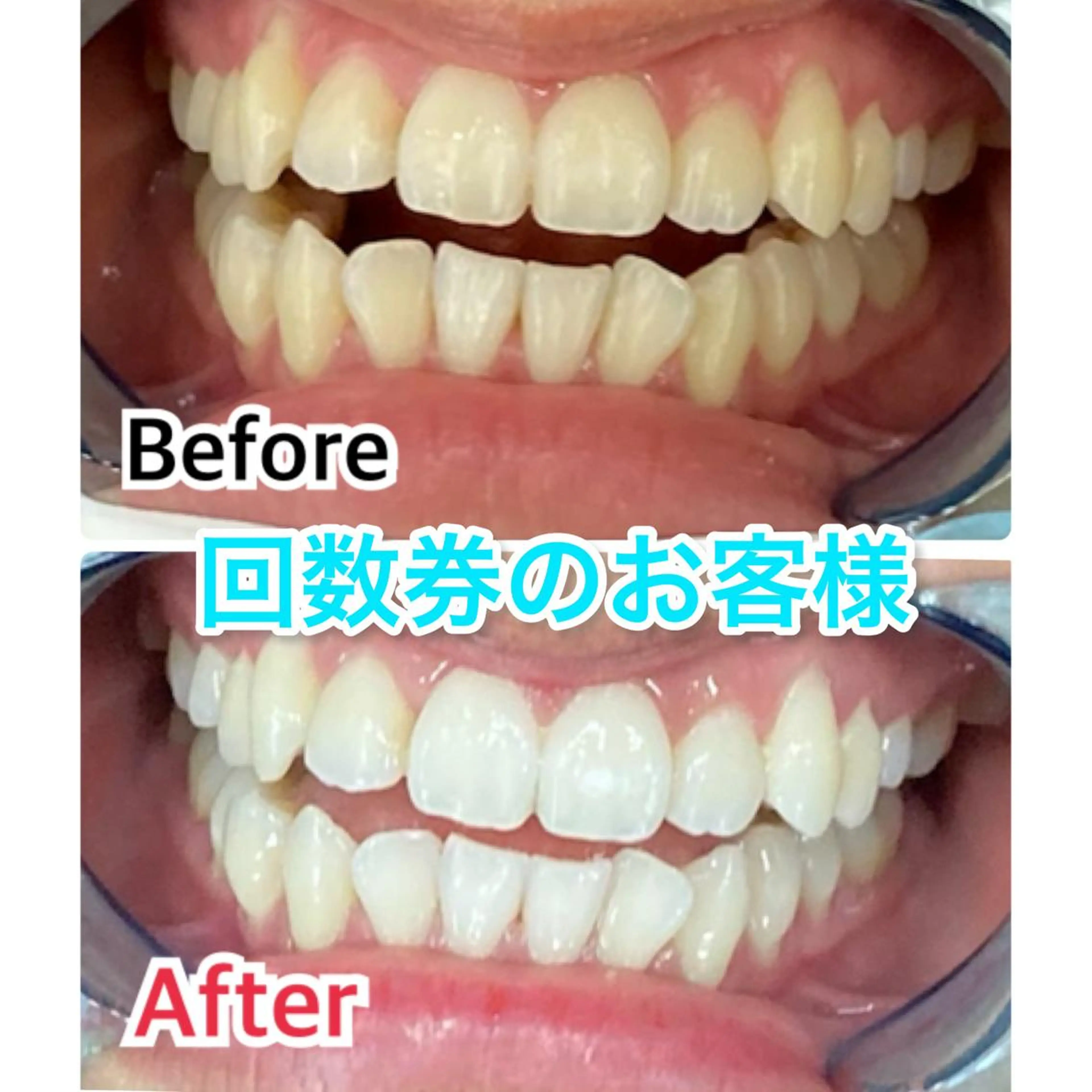 【歯科提携】柏ホワイ トニングスタイルのその他イメージ