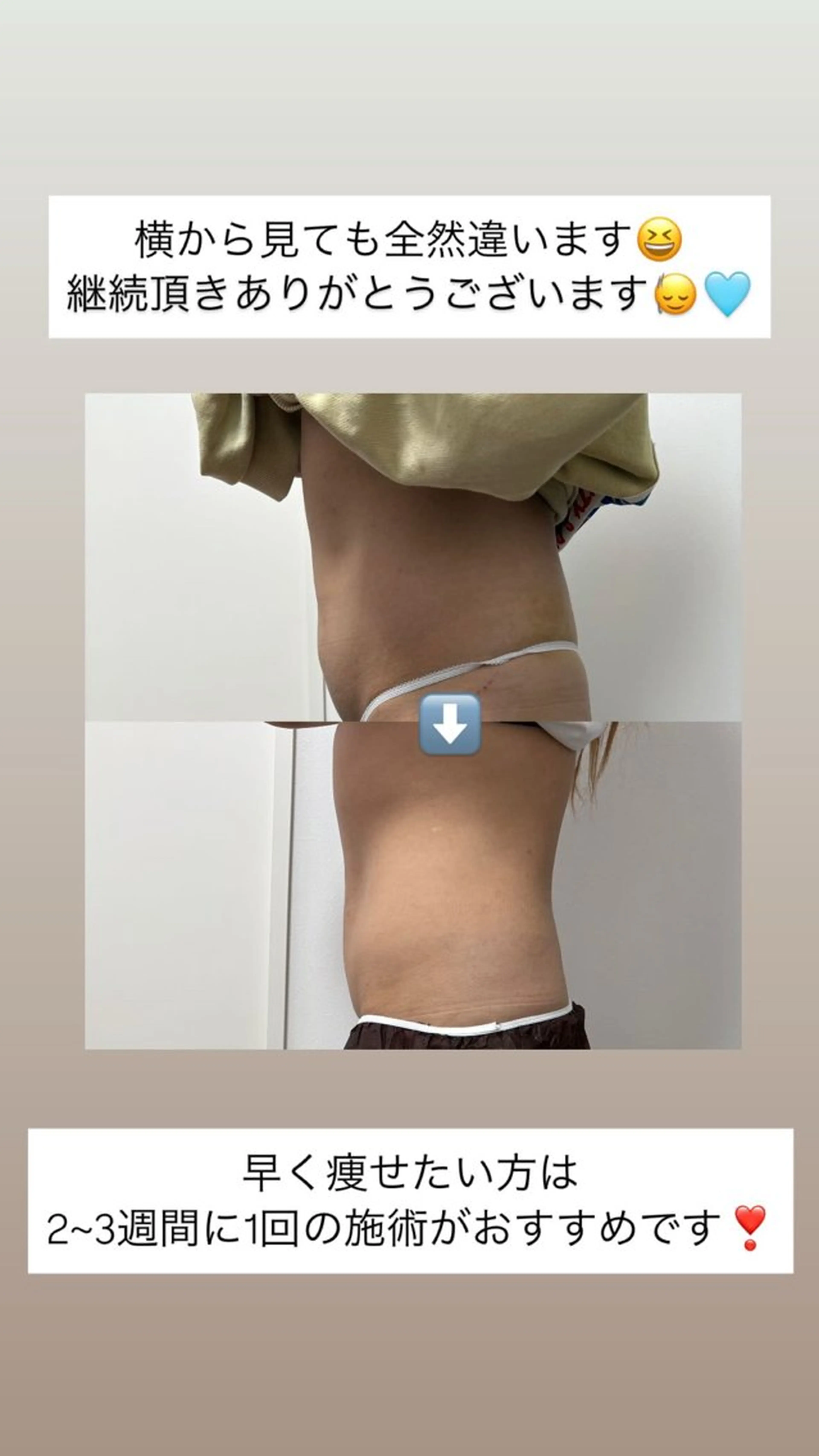 その他 石巻 冷却痩身 Miiju. 鈴木のエステ・リラクイメージ