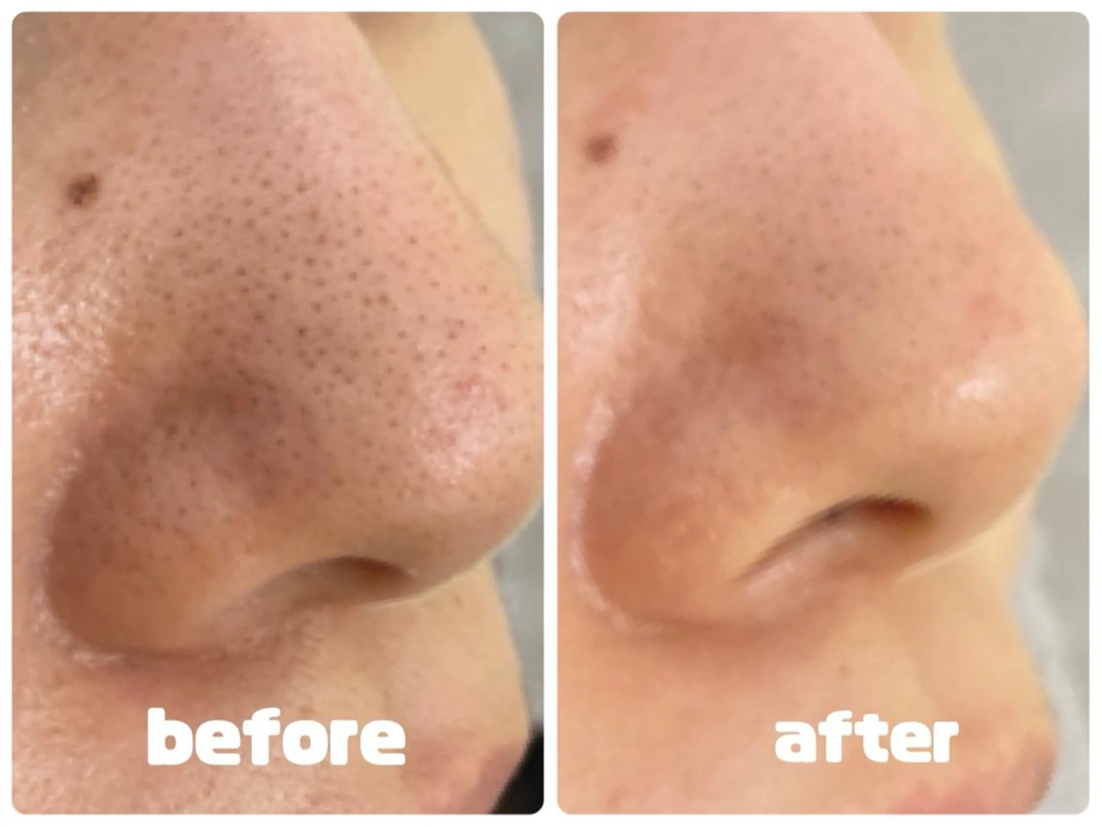 tutti所属・t uttiのマツエク・マツパデザイン