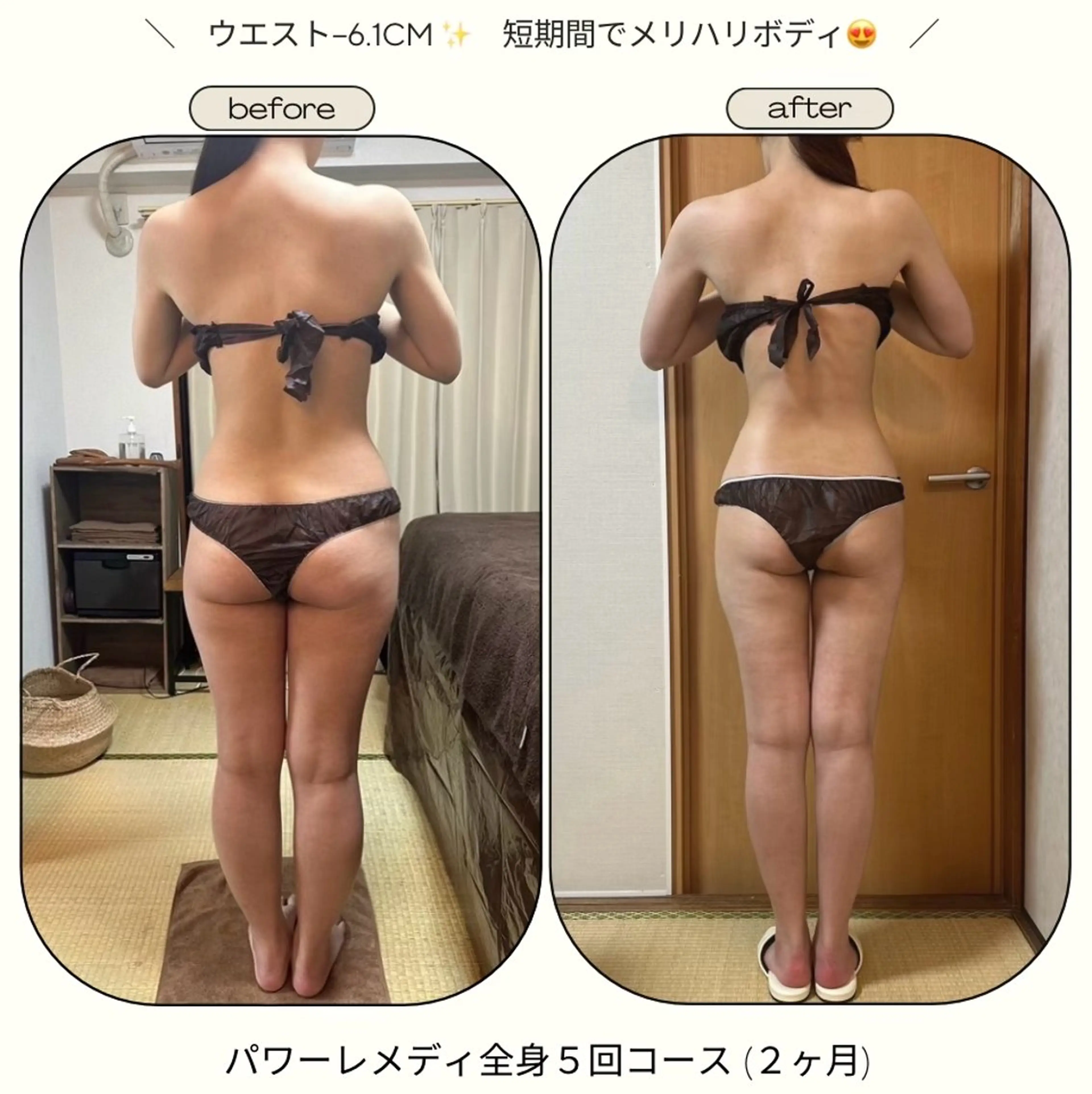 《本気痩せ×疲労改善 》  BILOOPのエステ・リラクイメージ