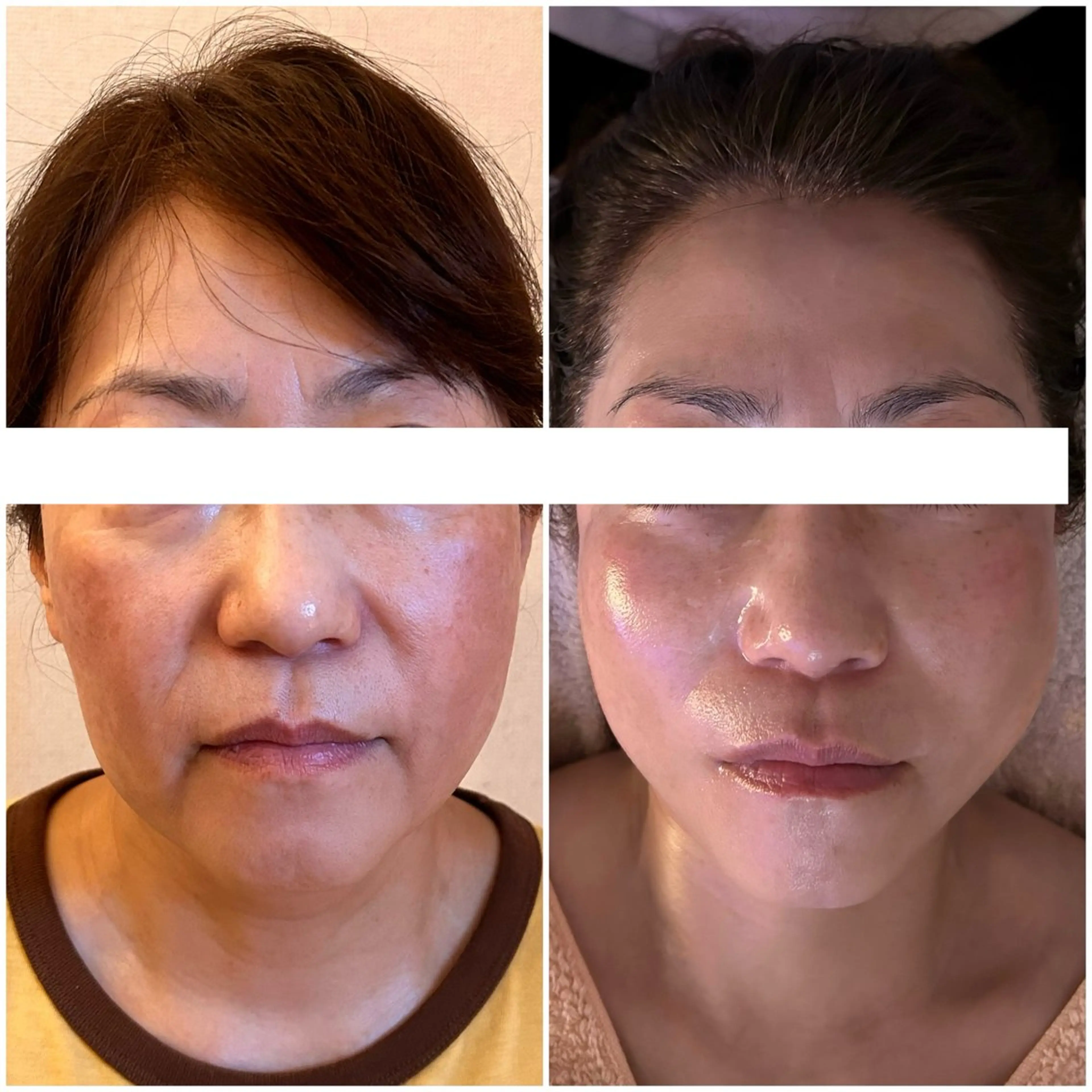 ヘッドスパ専門/豊中 apricotのエステ・リラクイメージ