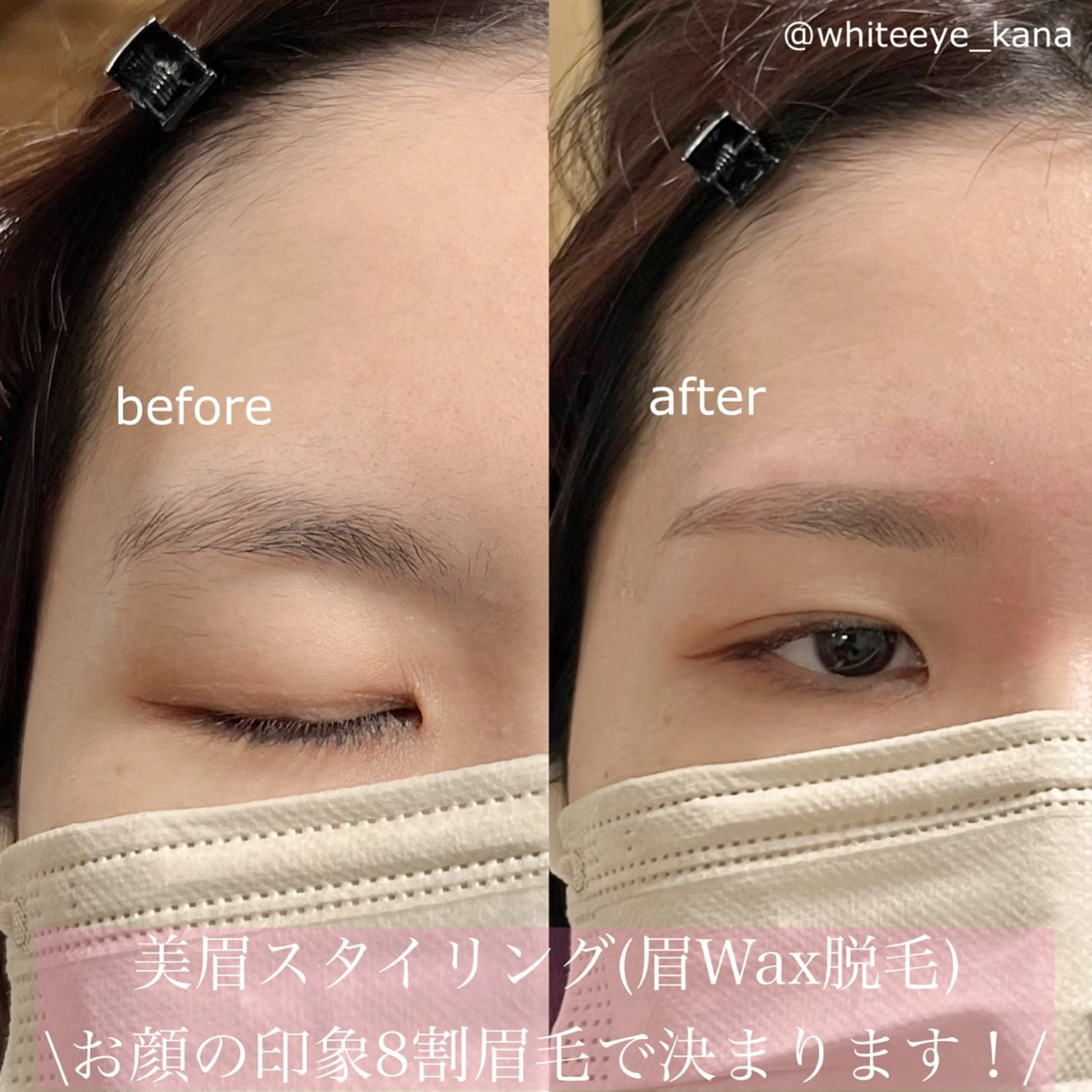 アイブロウ ワックス脱毛 眉カット その他(アイブロウ) WHITEEYE 🤍KANAの眉毛・アイブロウイメージ