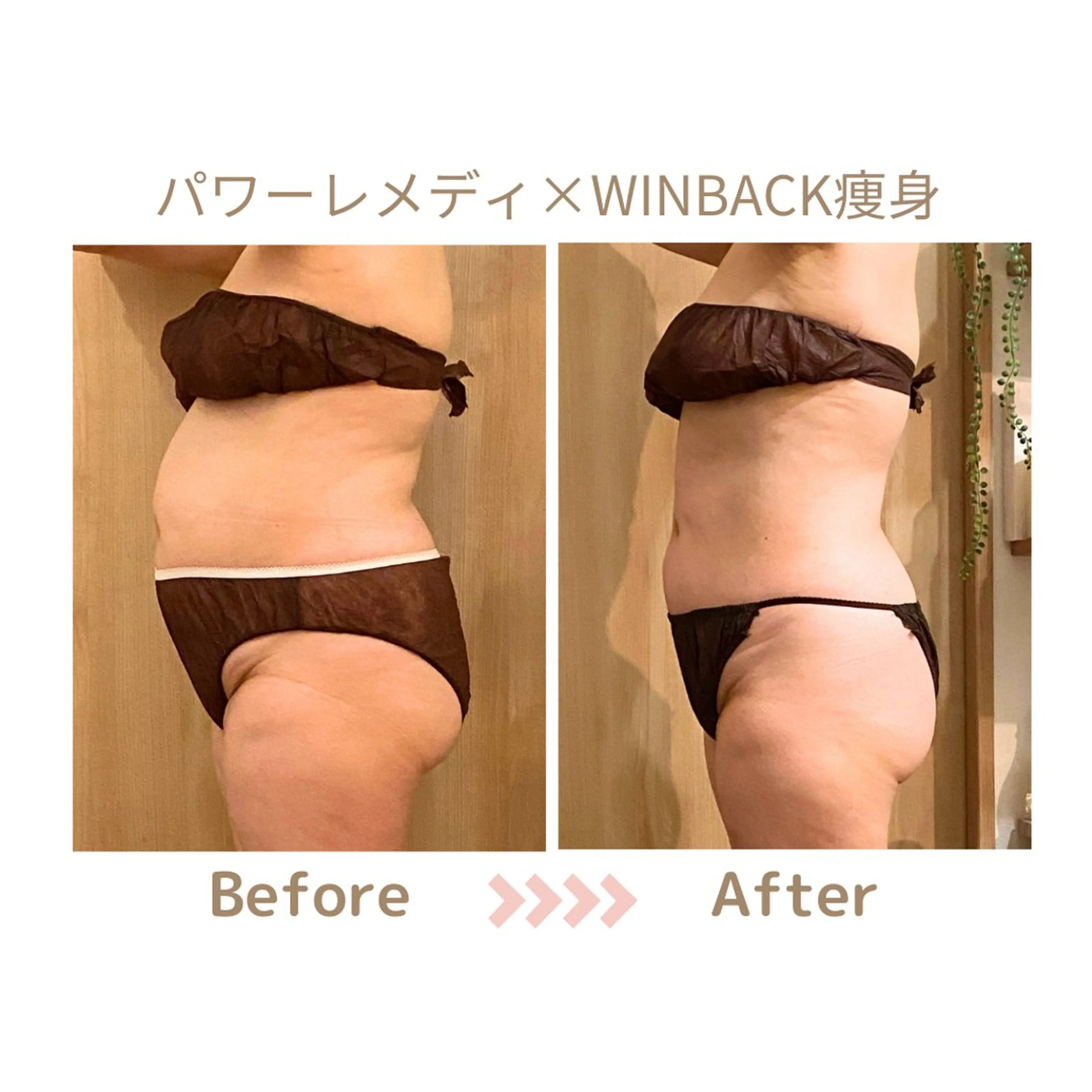 肌質改善×小顔サロン リトリト垣内のエステ・リラクイメージ