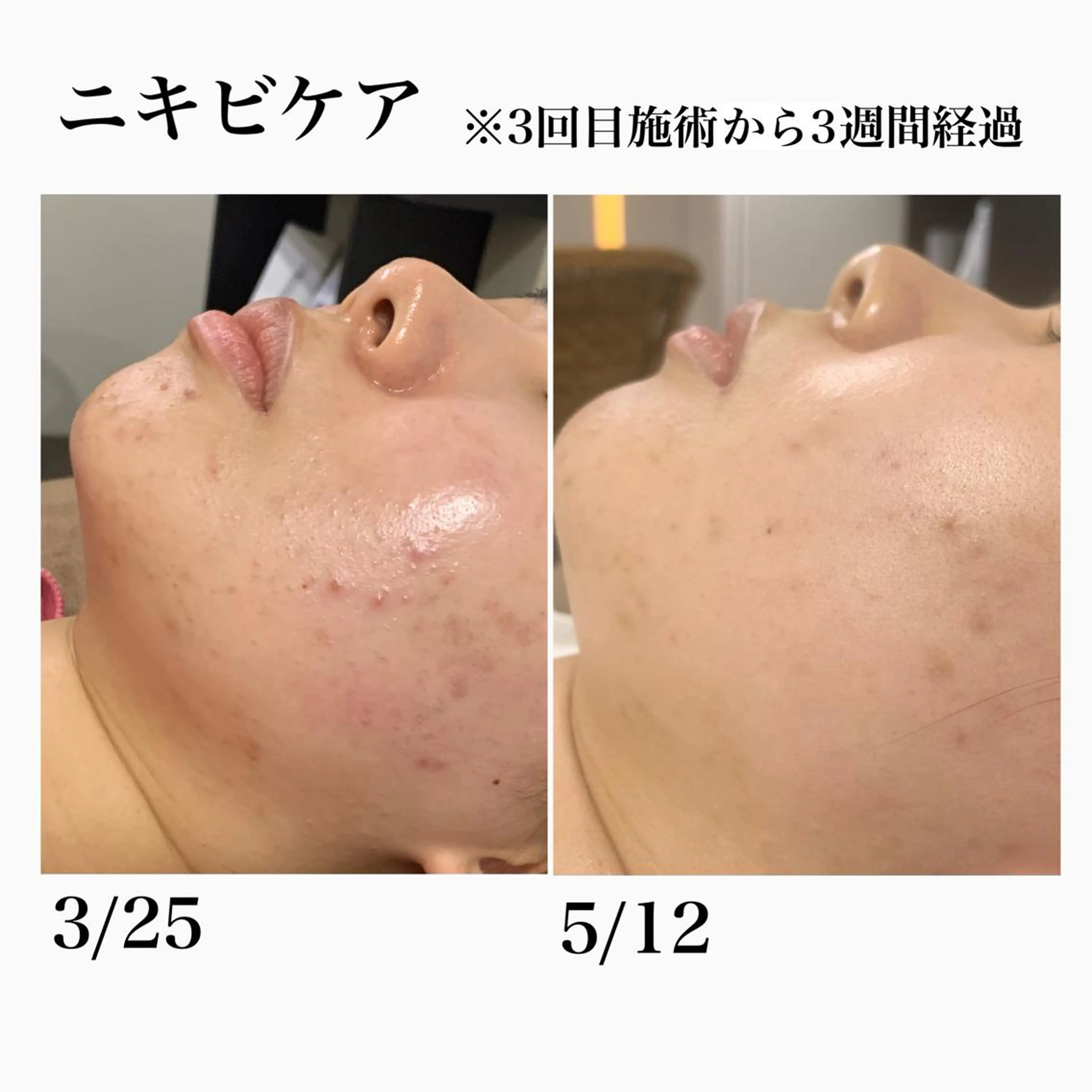 堀之内宏次 ［美容鍼灸師］のエステ・リラクイメージ