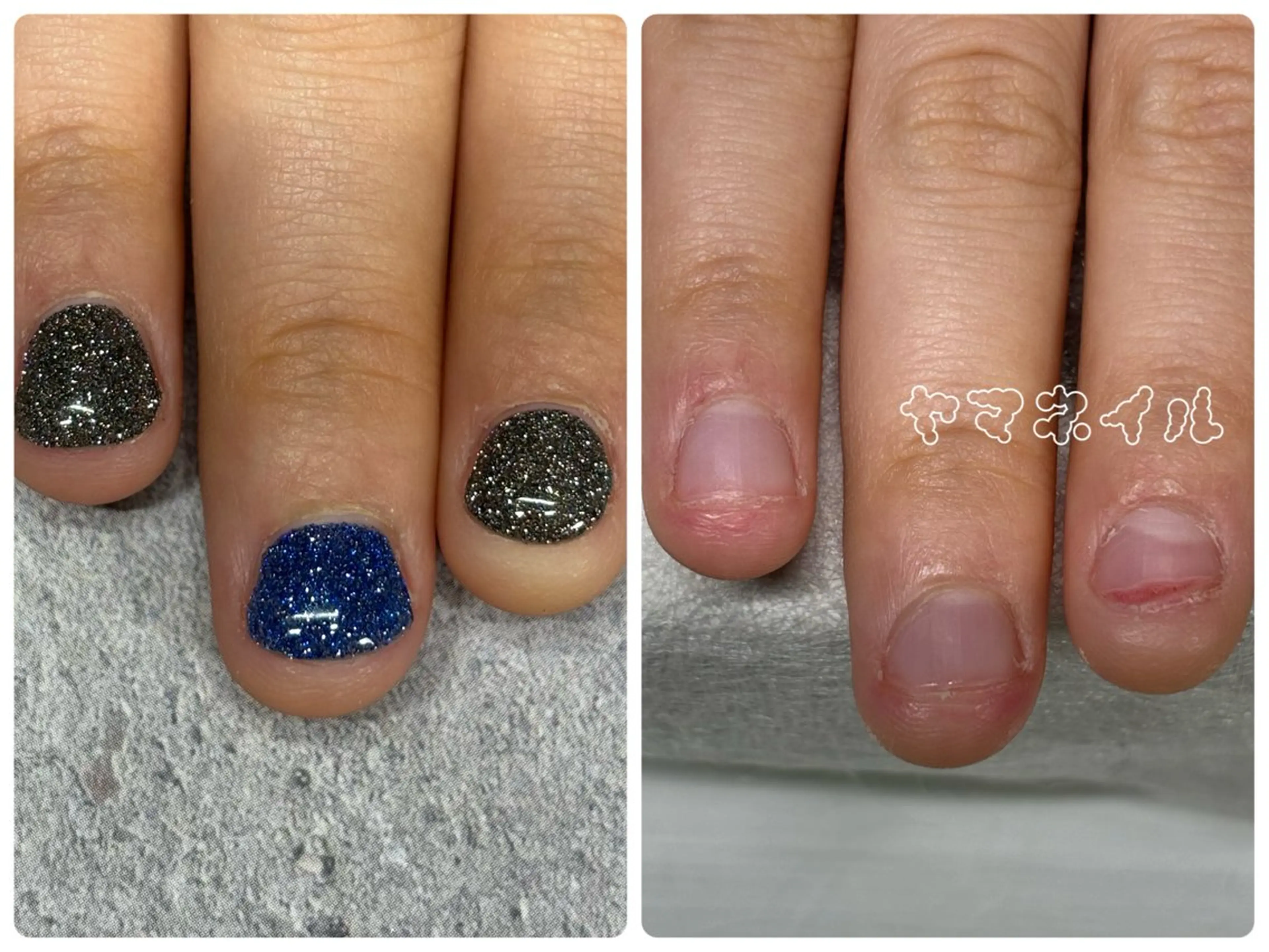 ネイル ネイル＆毛穴洗浄 ヤマネイル 山根のネイルデザイン