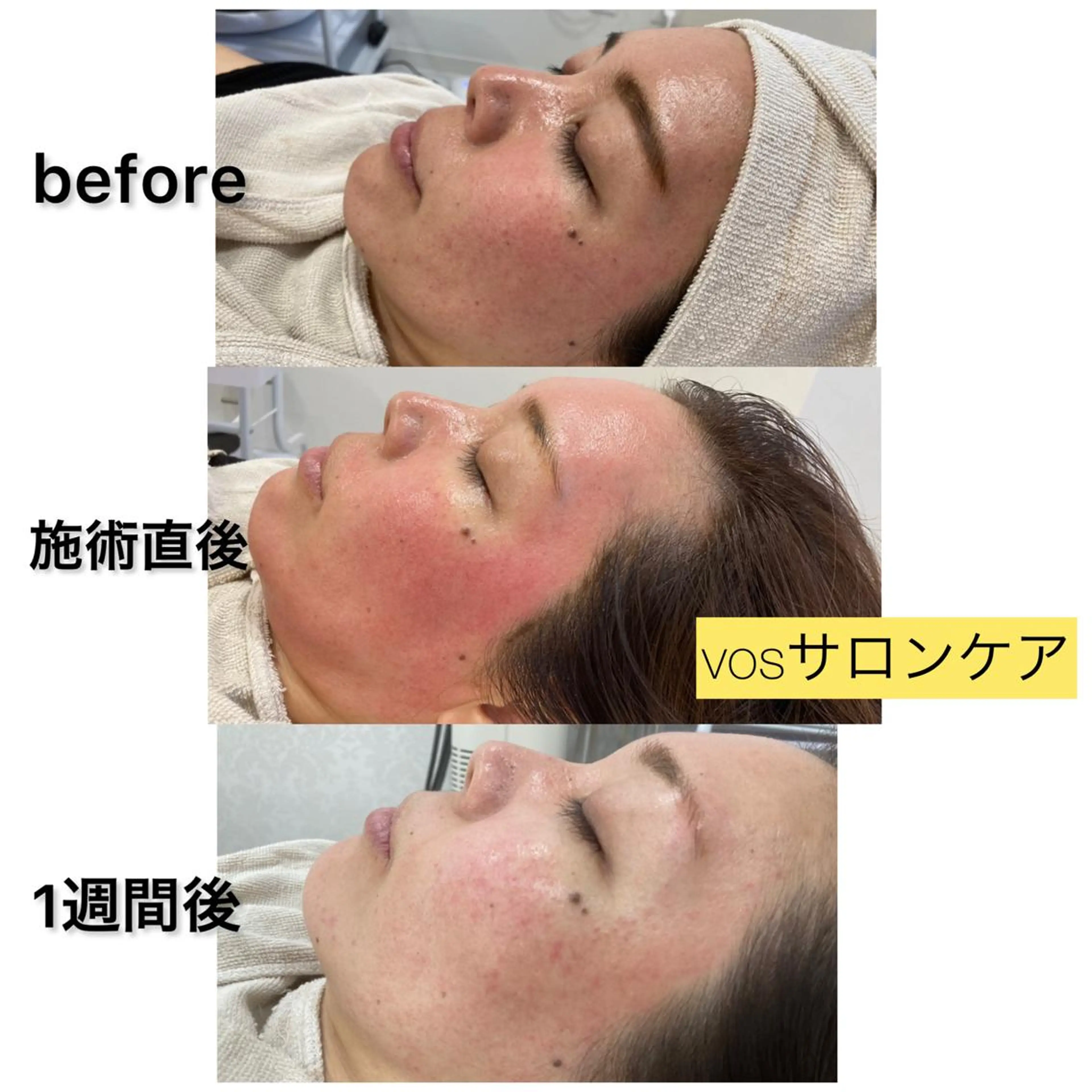 laluna saki...のその他イメージ