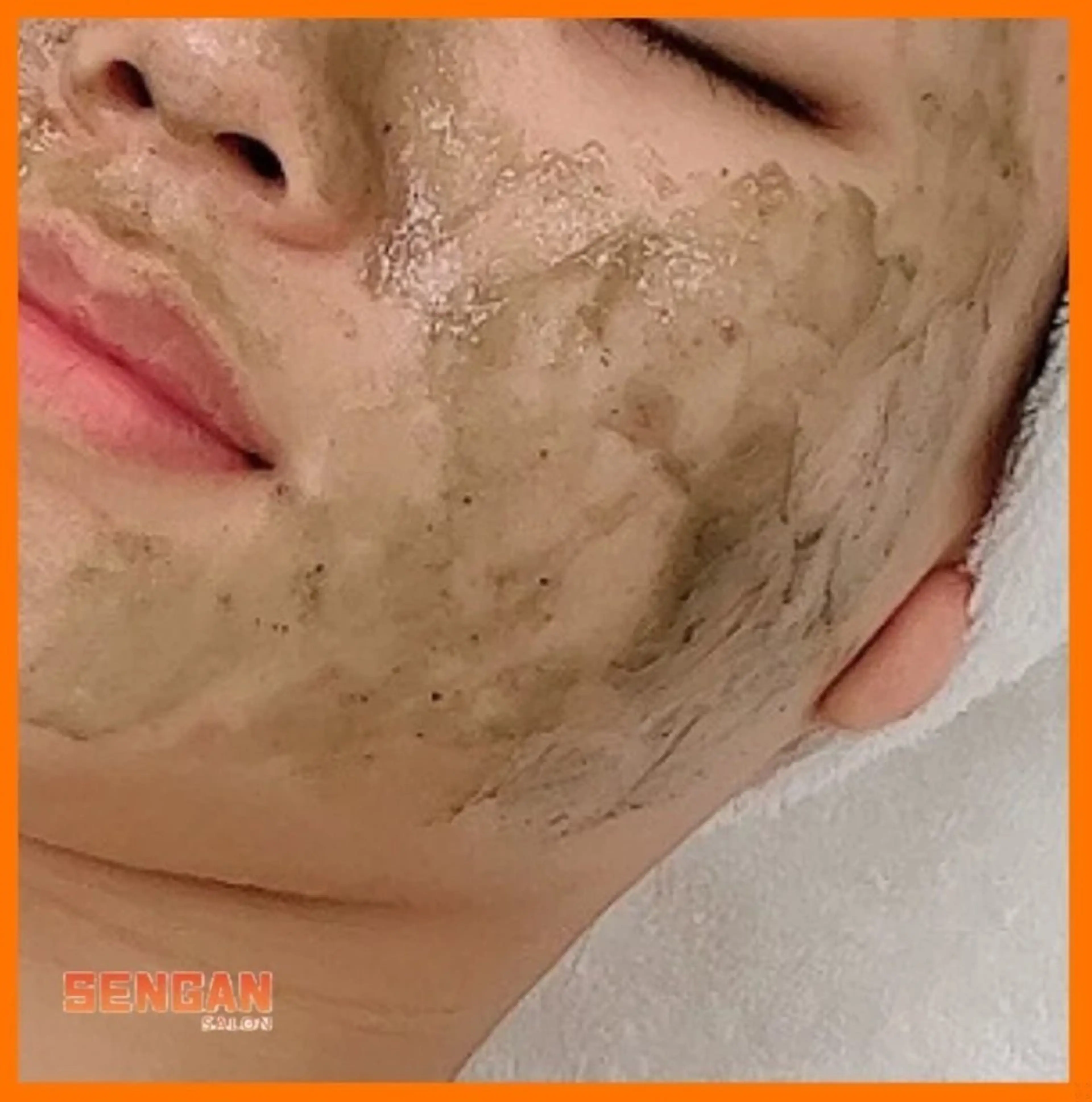 エステ 洗顔サロン池袋 毛穴洗浄のその他イメージ