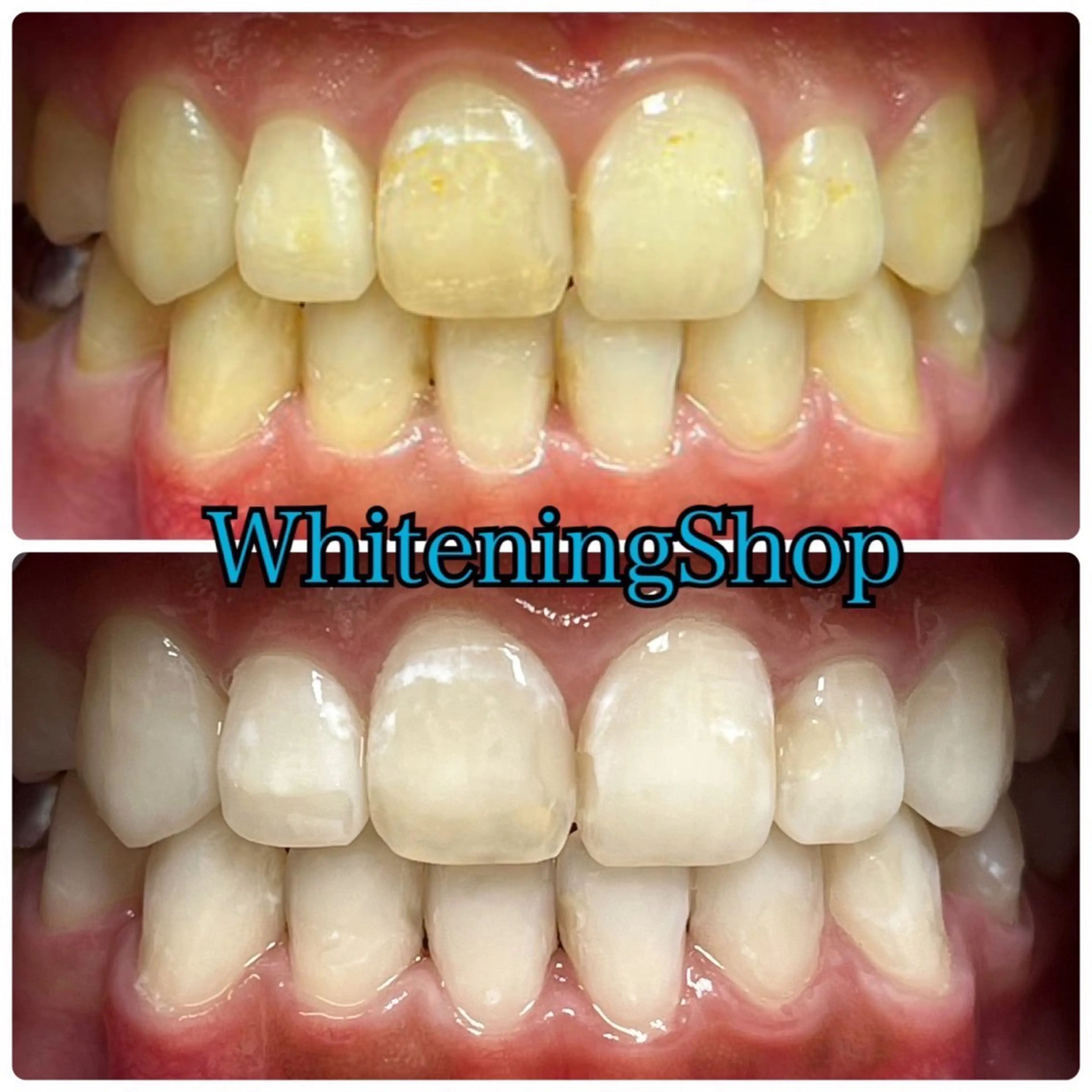 ホワイトニング ショップ吉祥寺店のエステ・リラクイメージ