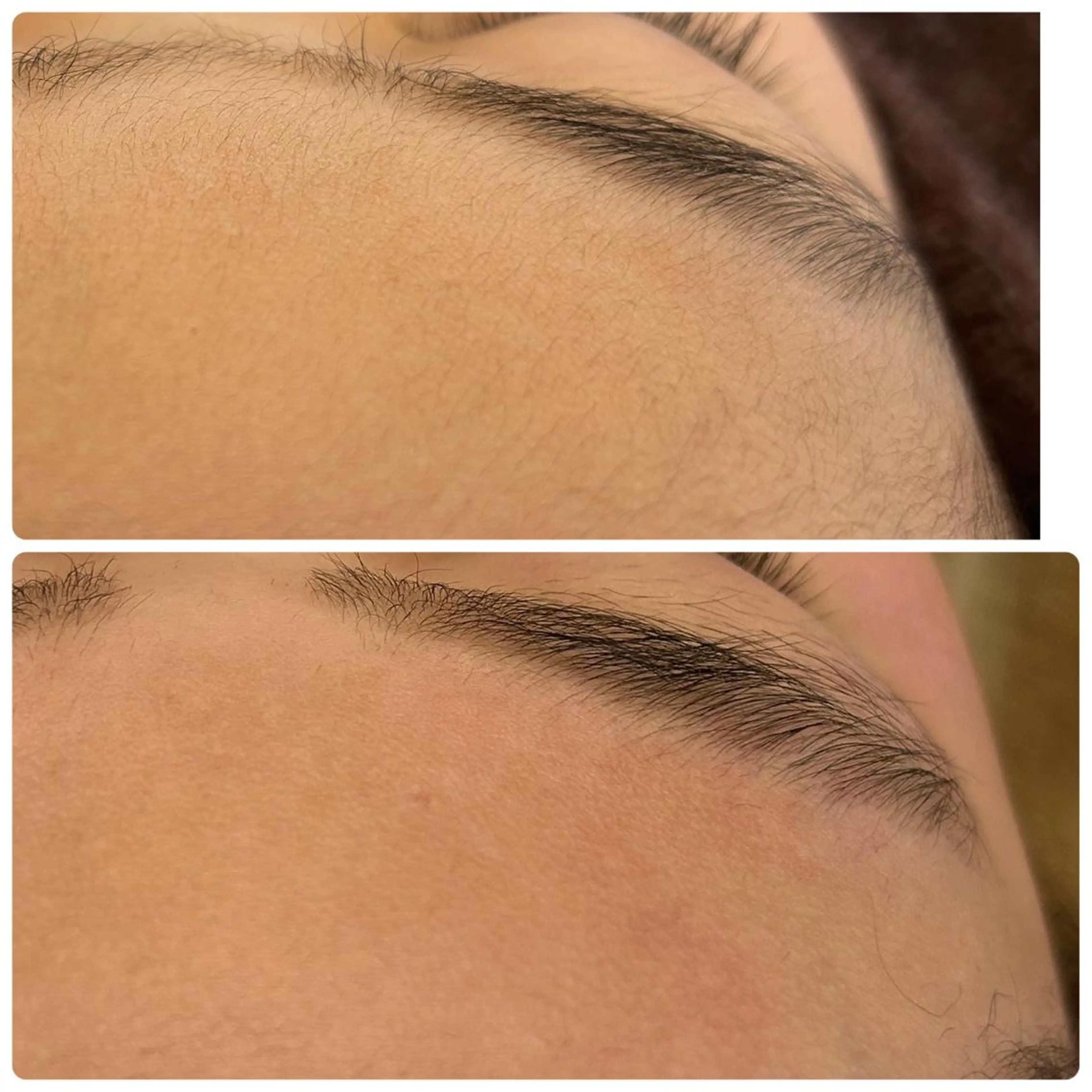 キッズ 脱毛 STELLAR. 谷岡恵里香のエステ・リラクイメージ