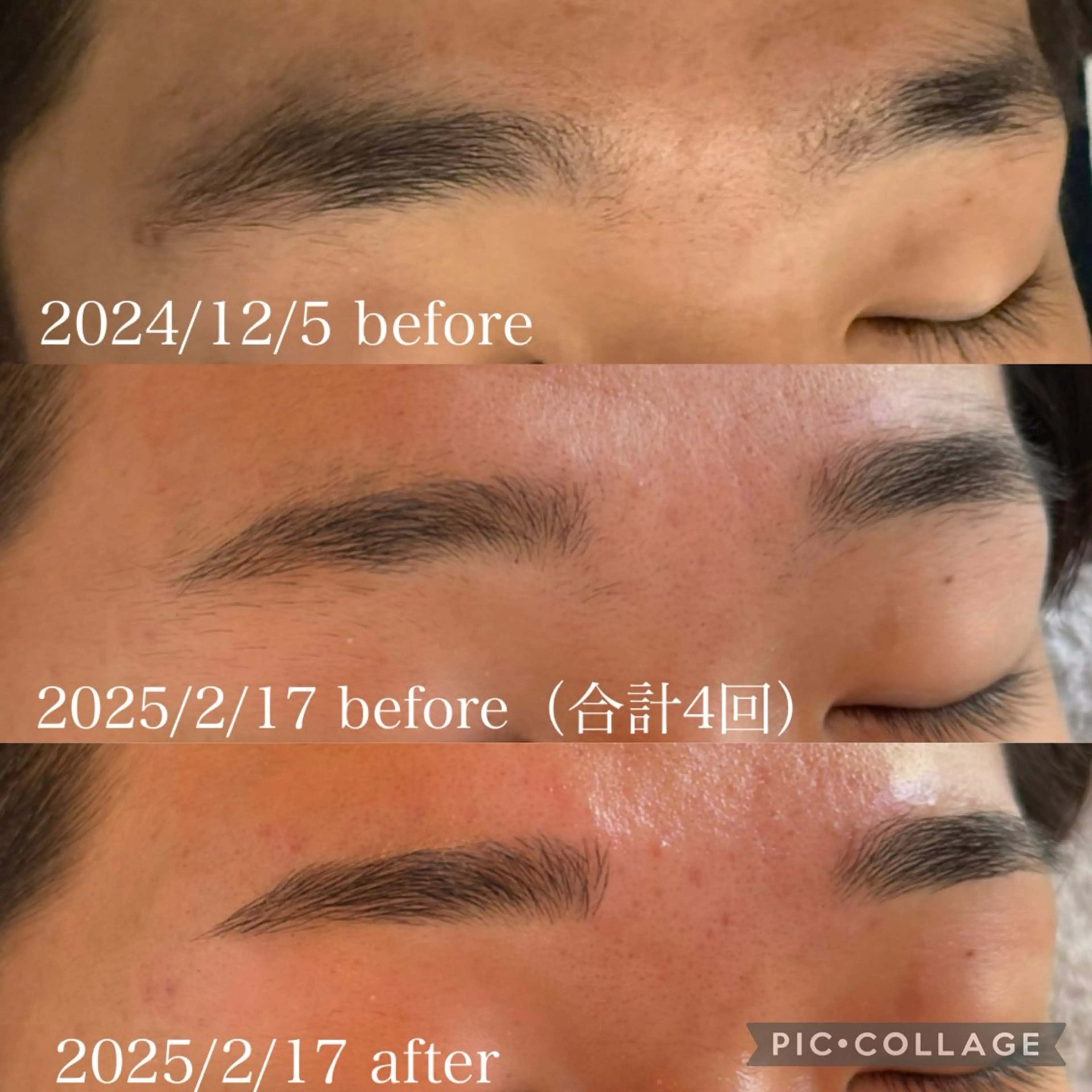 アイブロウ メンズアイブロウ ワックス脱毛 眉カット その他(アイブロウ) 眉毛/小顔/ハーブ 🌼hikaruの眉毛・アイブロウイメージ