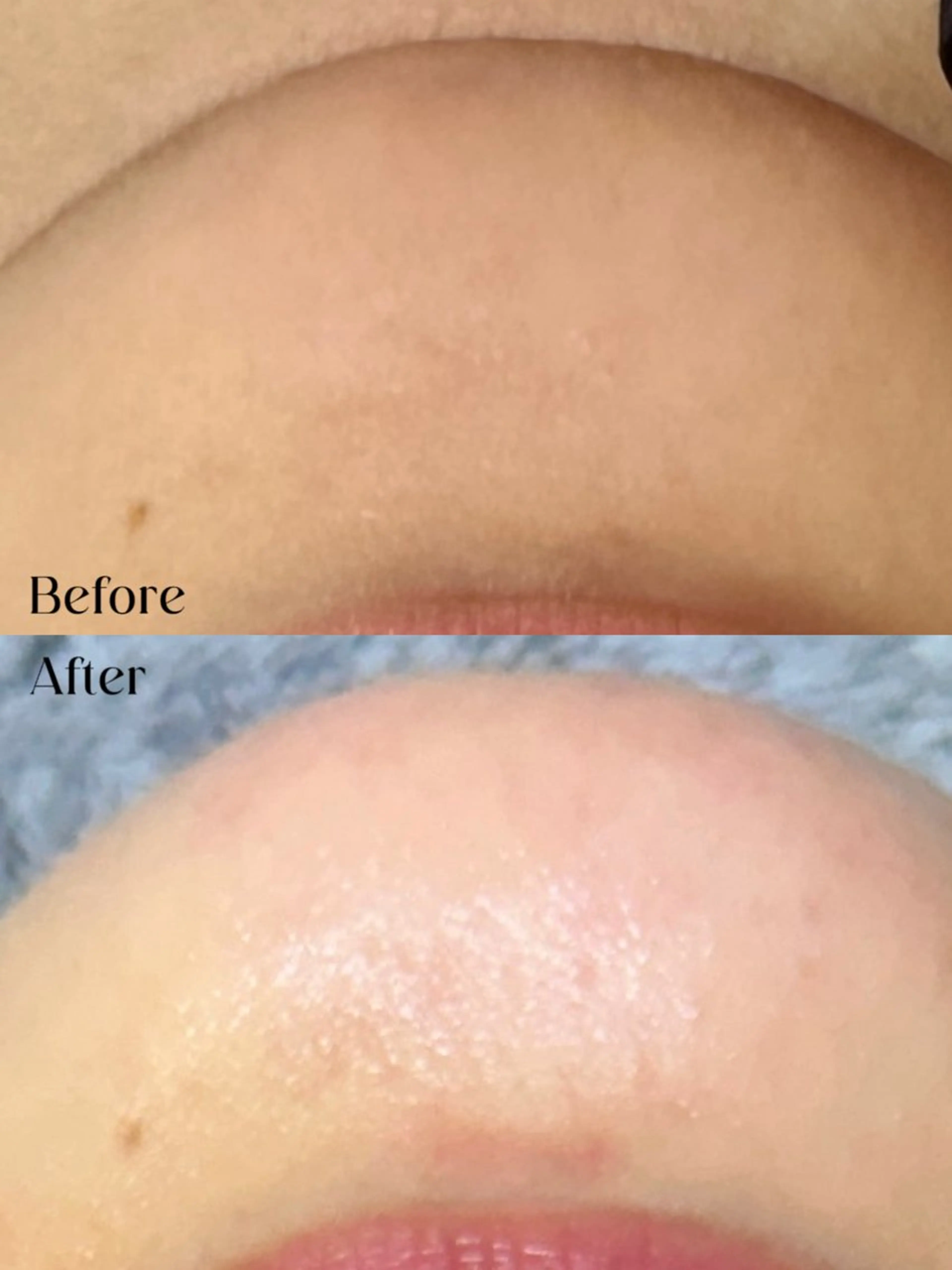 Hitomi シュガーリング豊橋のその他イメージ