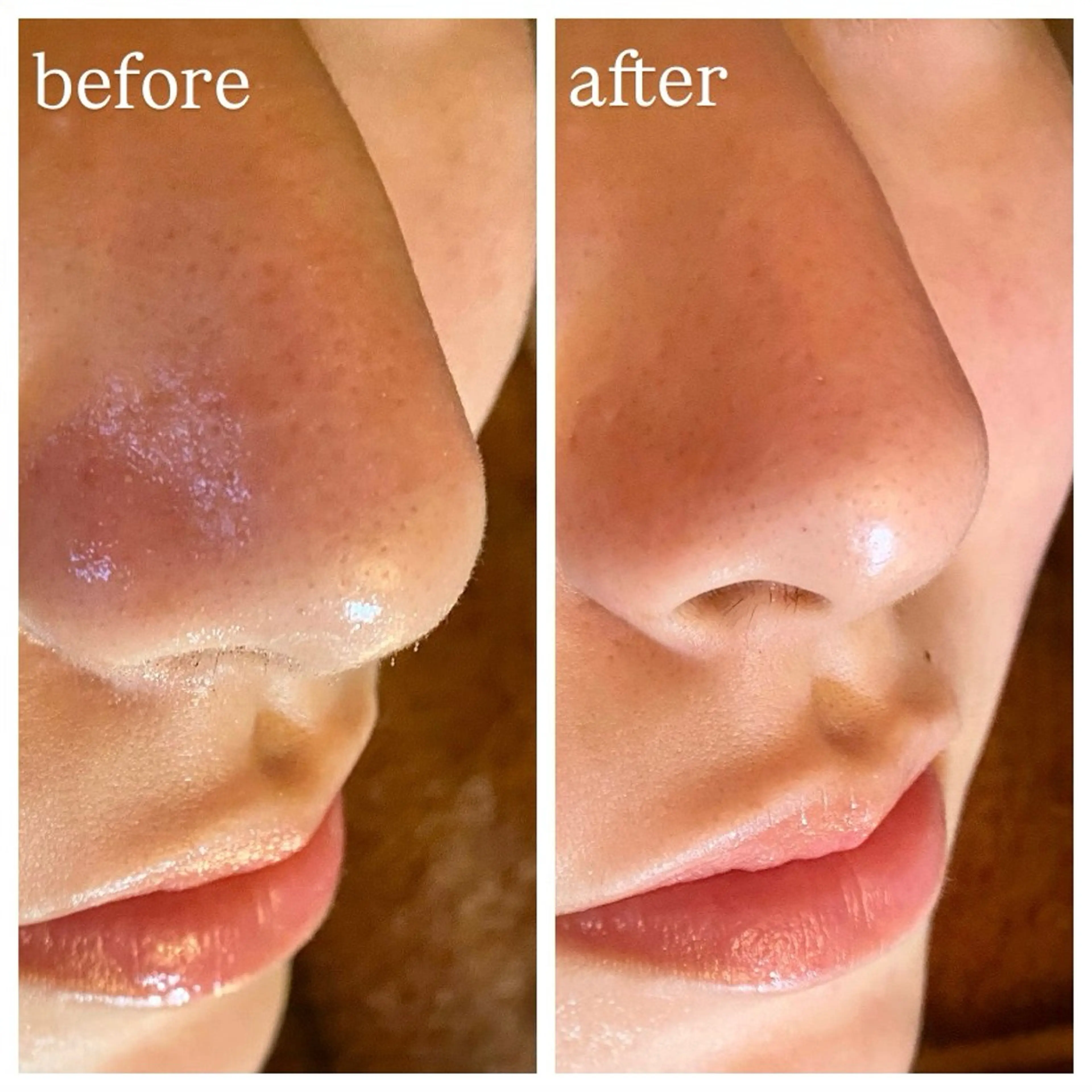 エステ 肌質改善専門 ハーブ /毛穴洗浄 リエイトのエステ・リラクイメージ