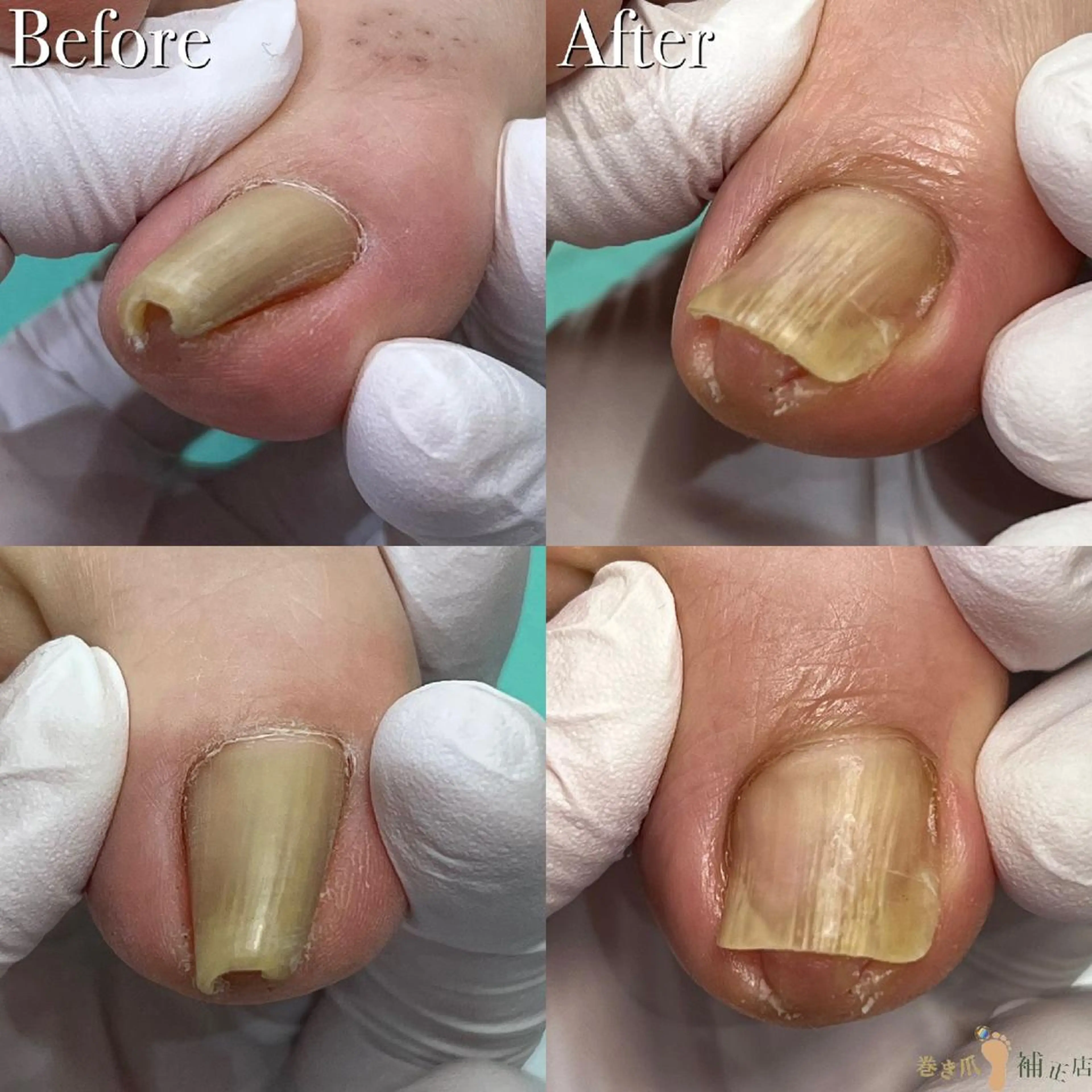 東京巻き爪 アカデミーのエステ・リラクイメージ