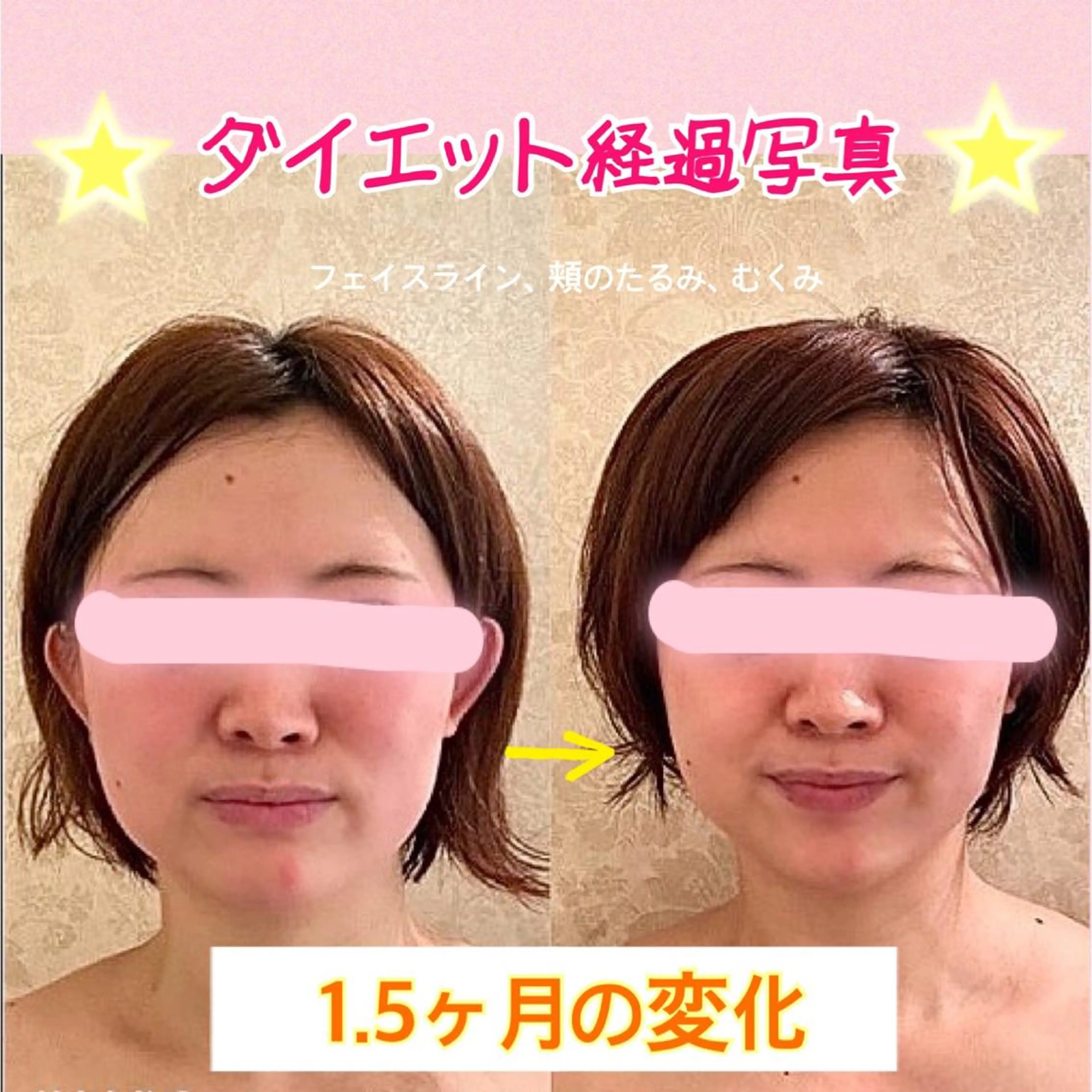 ショート カラー パーマ ヘアアレンジ メンズ キッズ ネイル マツエク・マツパ 痩身&ボディ 結果出し🌟丹野のエステ・リラクイメージ