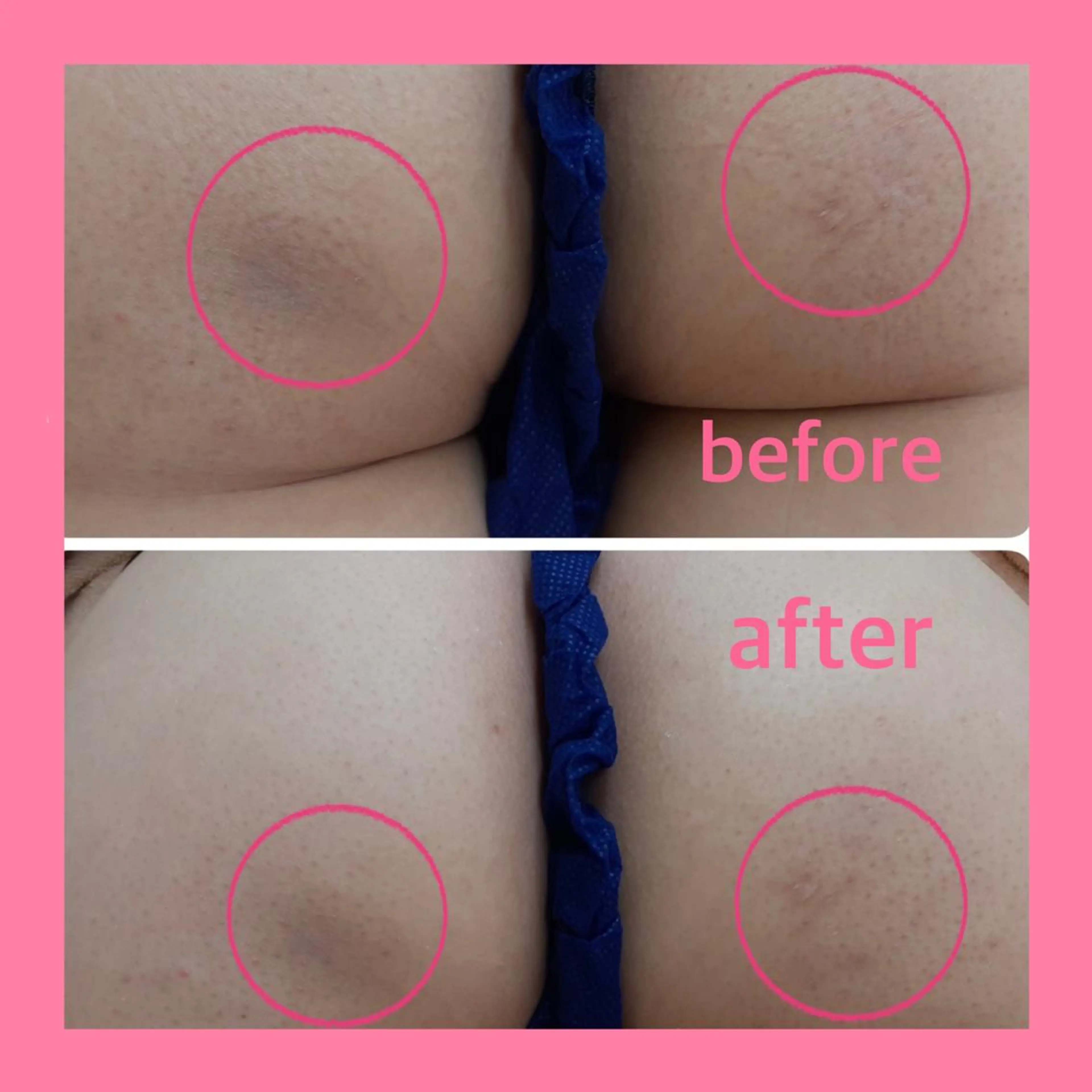 肌ケア＆毛穴洗浄 Cheri/女性専用のエステ・リラクイメージ