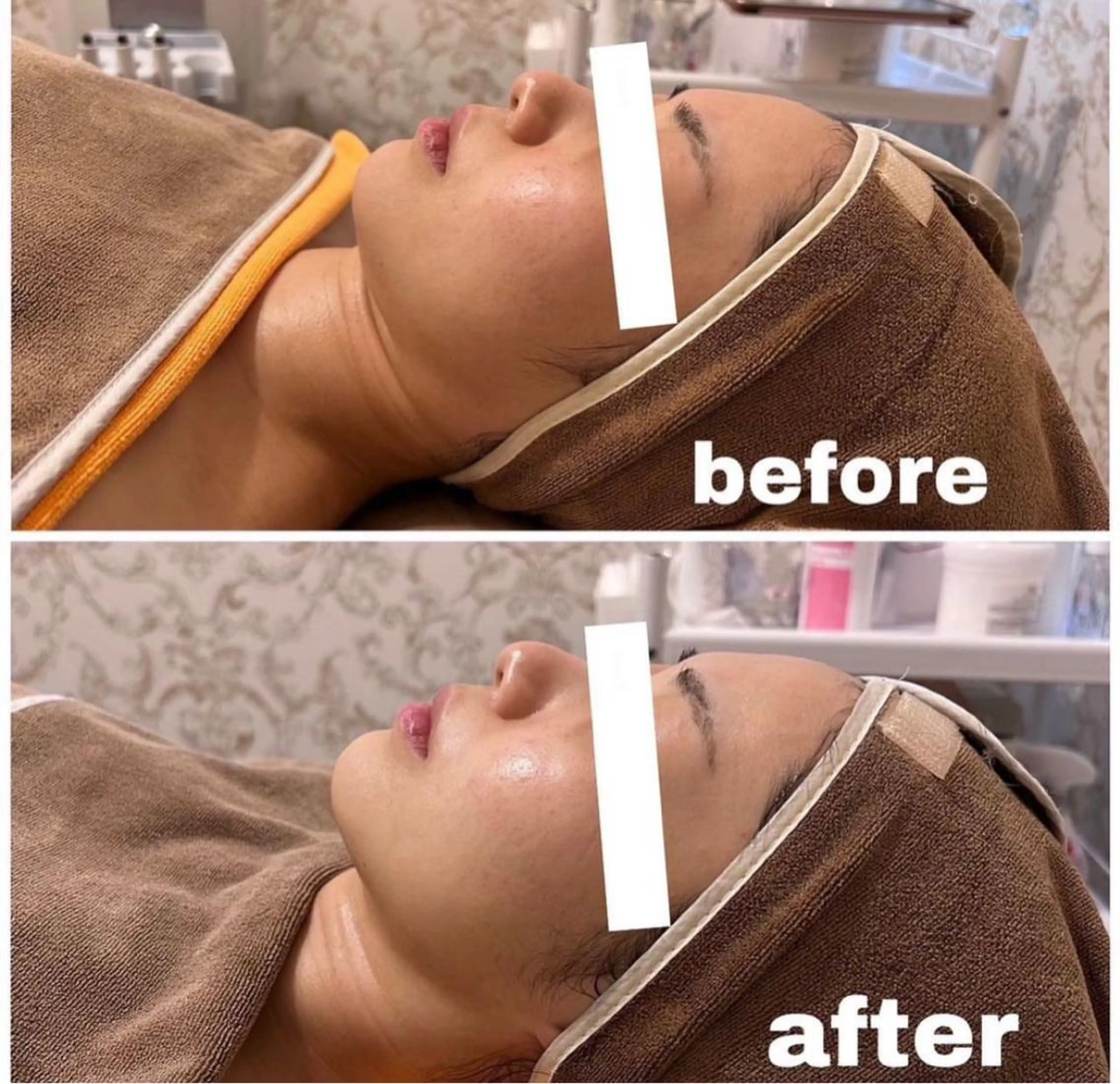 西区九条エステ MITUREIサロンのエステ・リラクイメージ