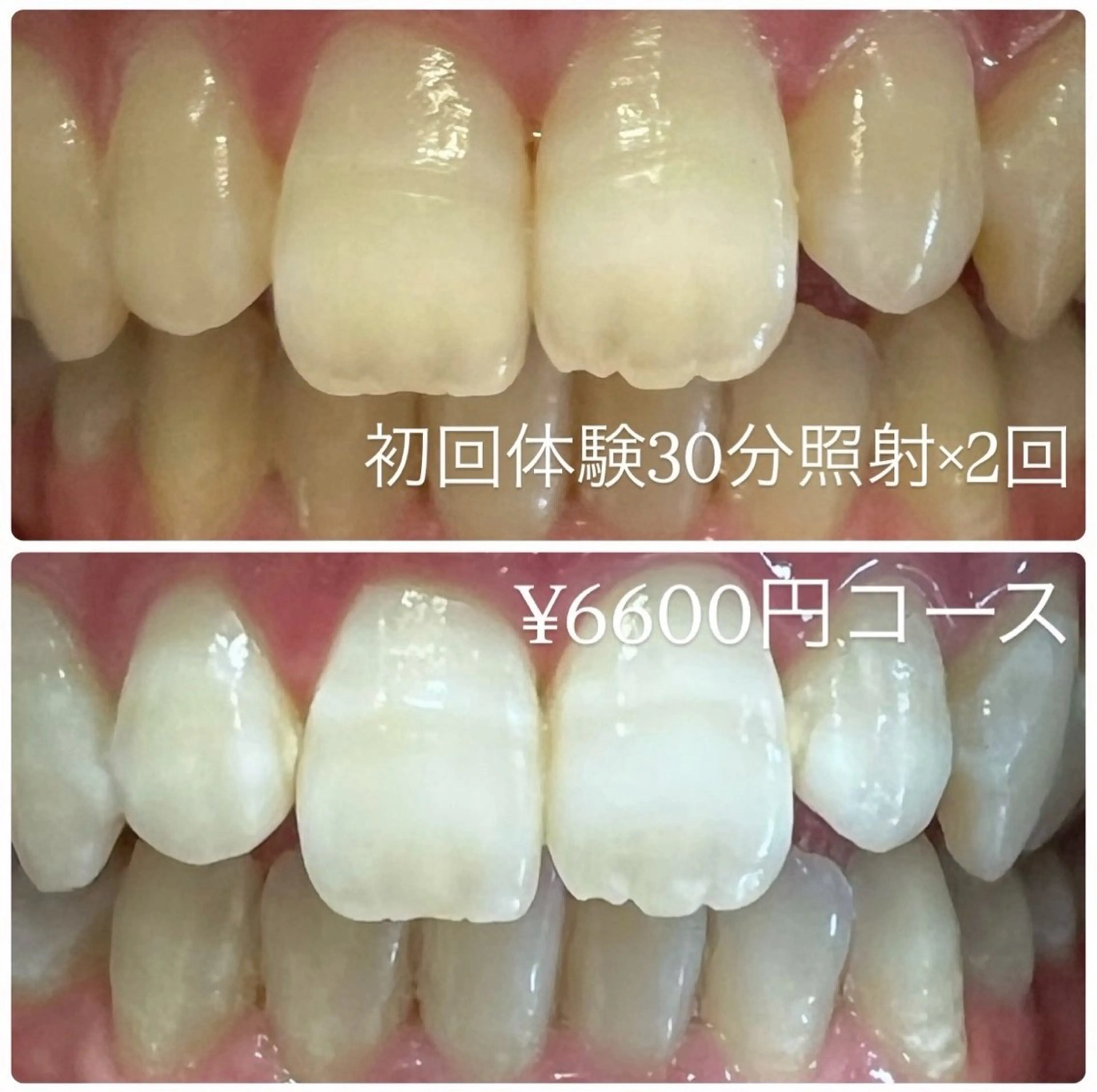 その他 ホワイトニングルーム 横浜店のその他イメージ