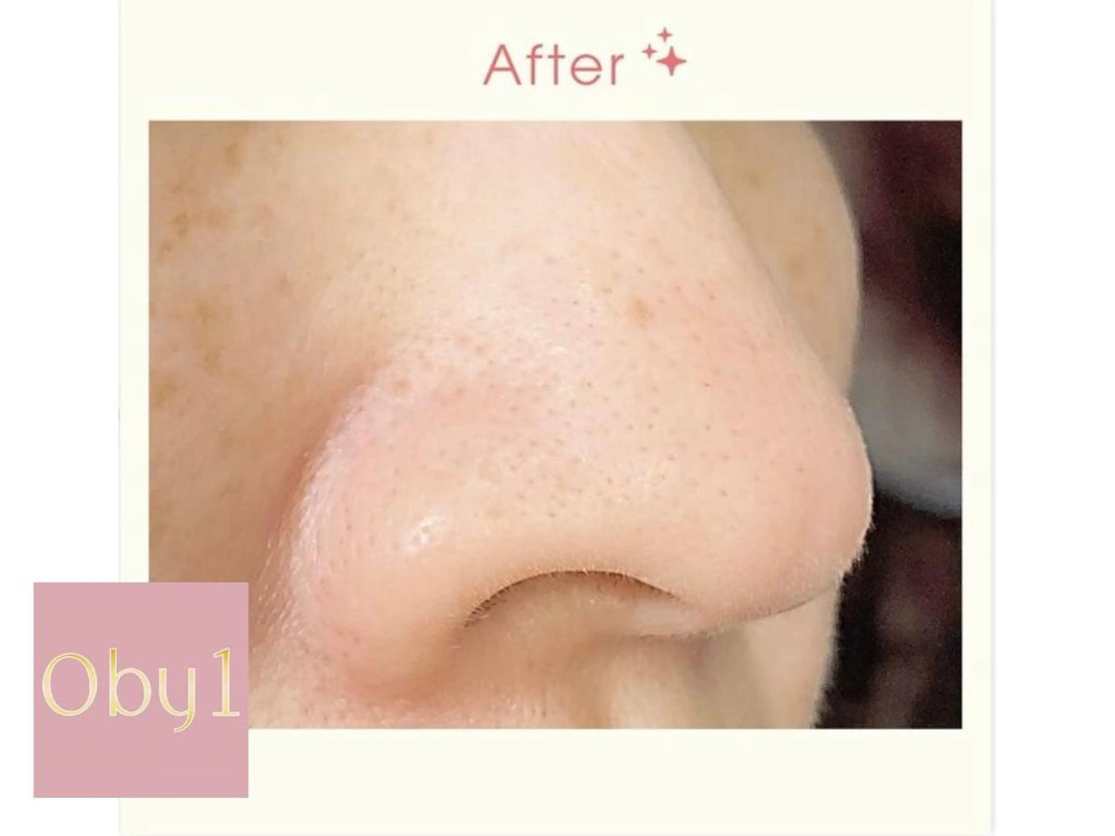 肌管理/ピーリング オーバイワン恵比寿のエステ・リラクイメージ