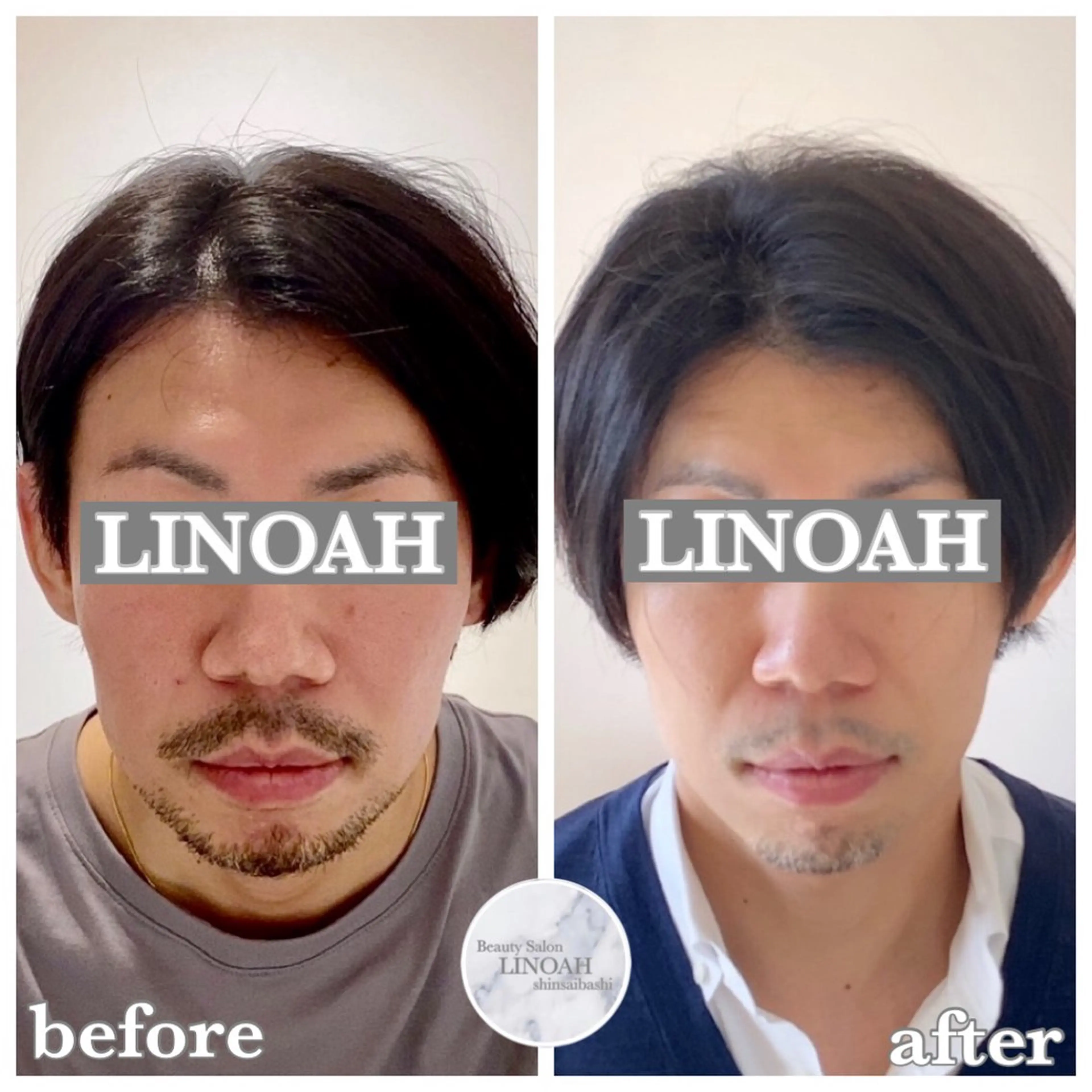 メンズ ビューティーサロン リノア心斎橋店のエステ・リラクイメージ