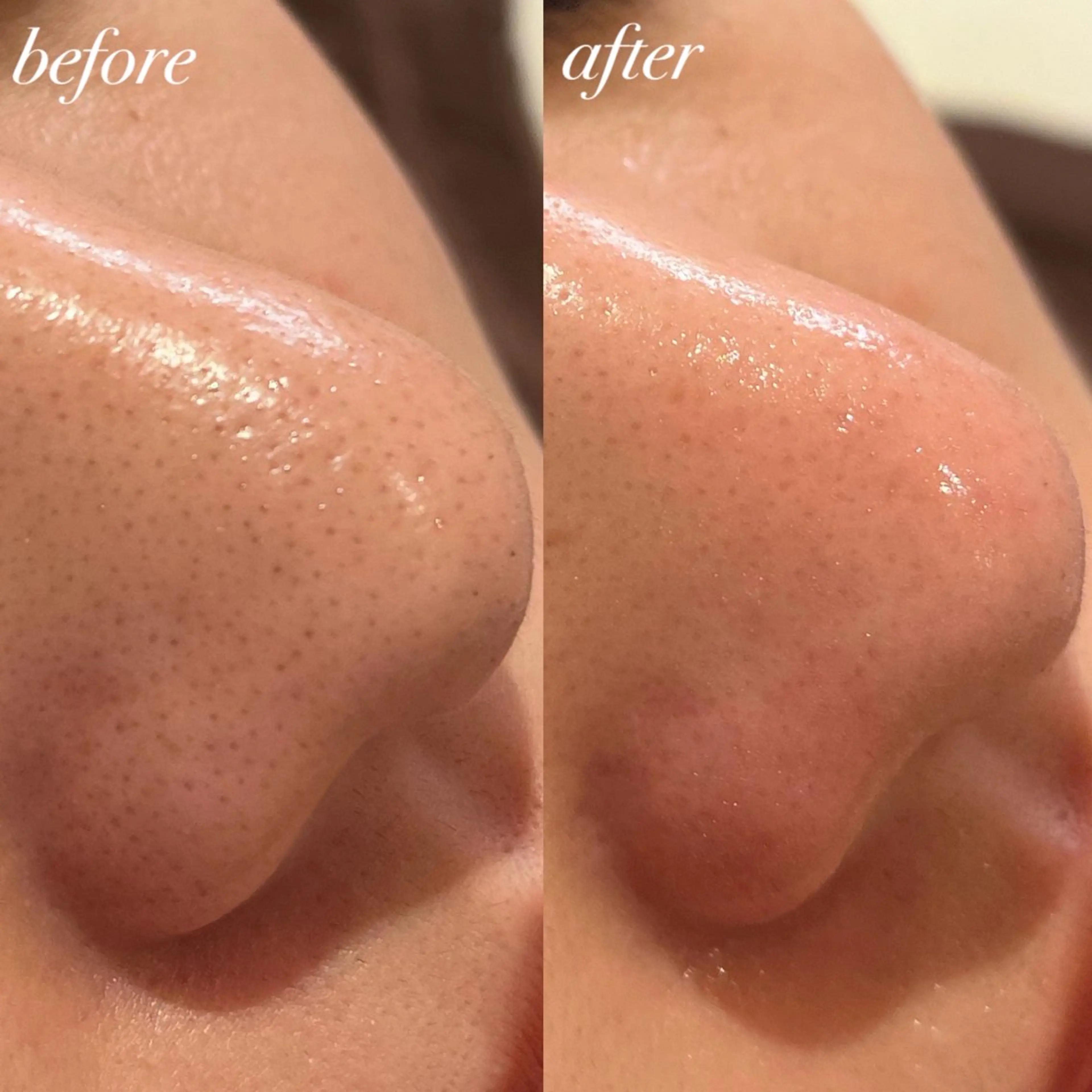 エステ 美養サロンハレハダ／ kanakoの眉毛・アイブロウイメージ