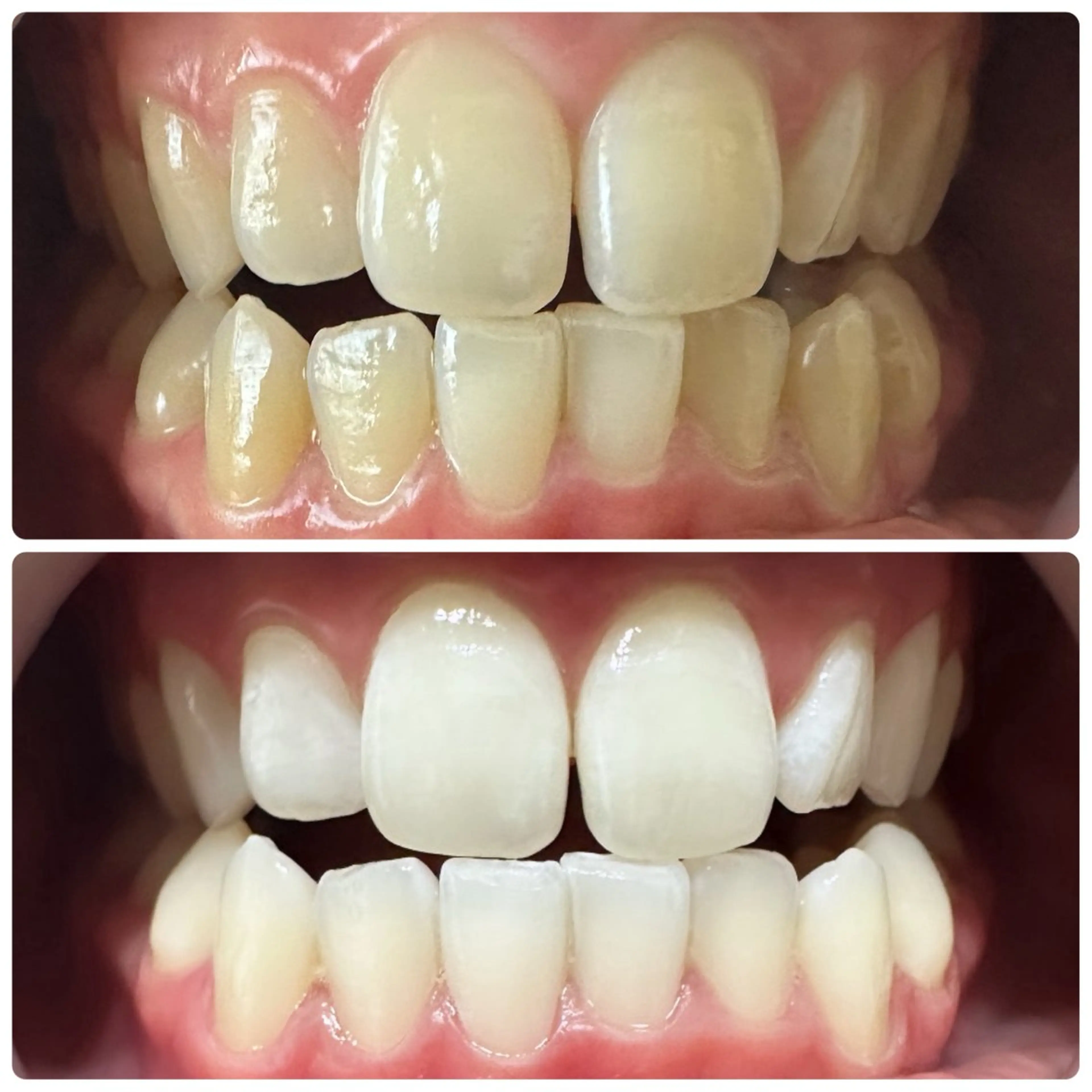 ネイル ホワイト 歯のホワイトニング 専門店&whiteのその他イメージ