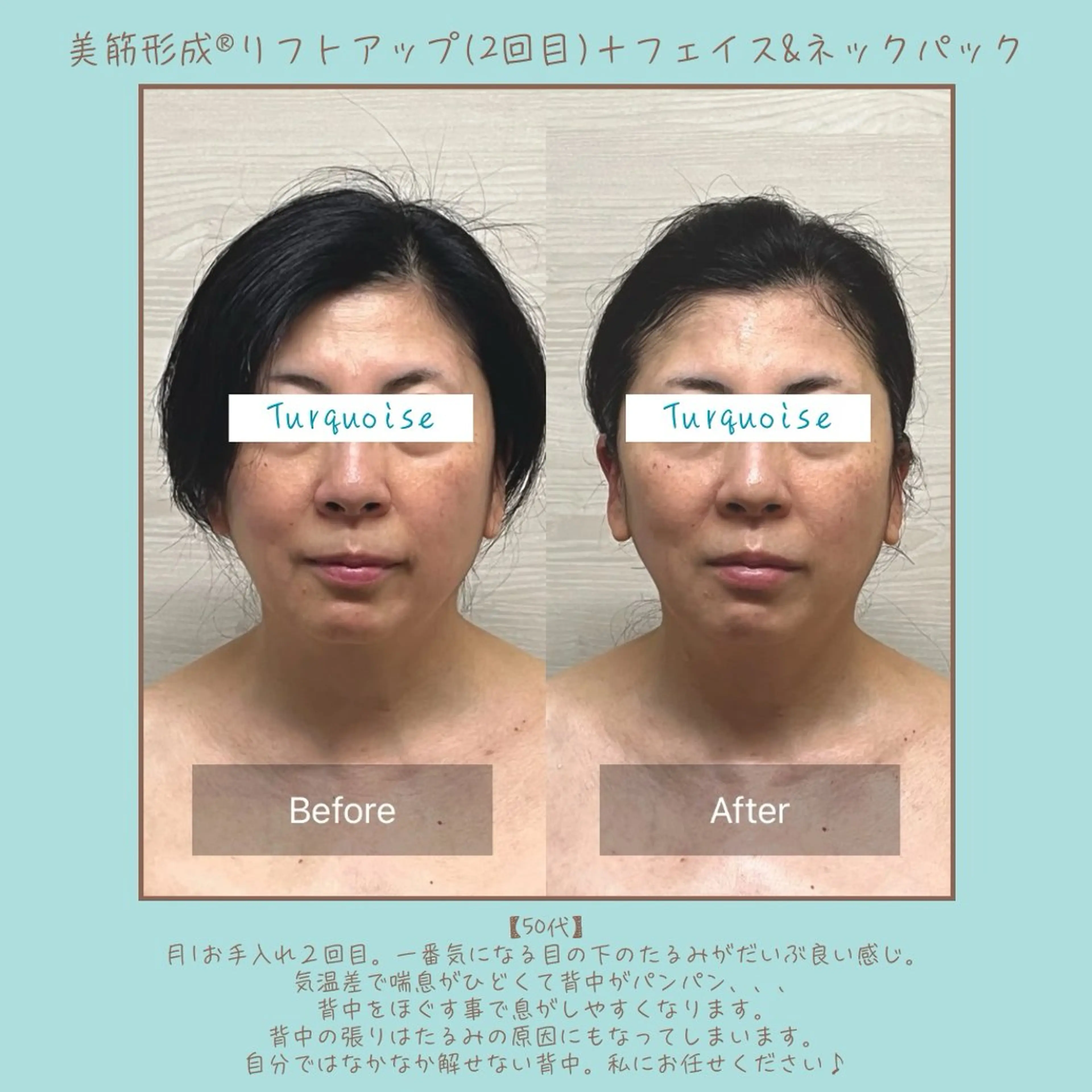 フェイシャルエステ Turquoiseのエステ・リラクイメージ