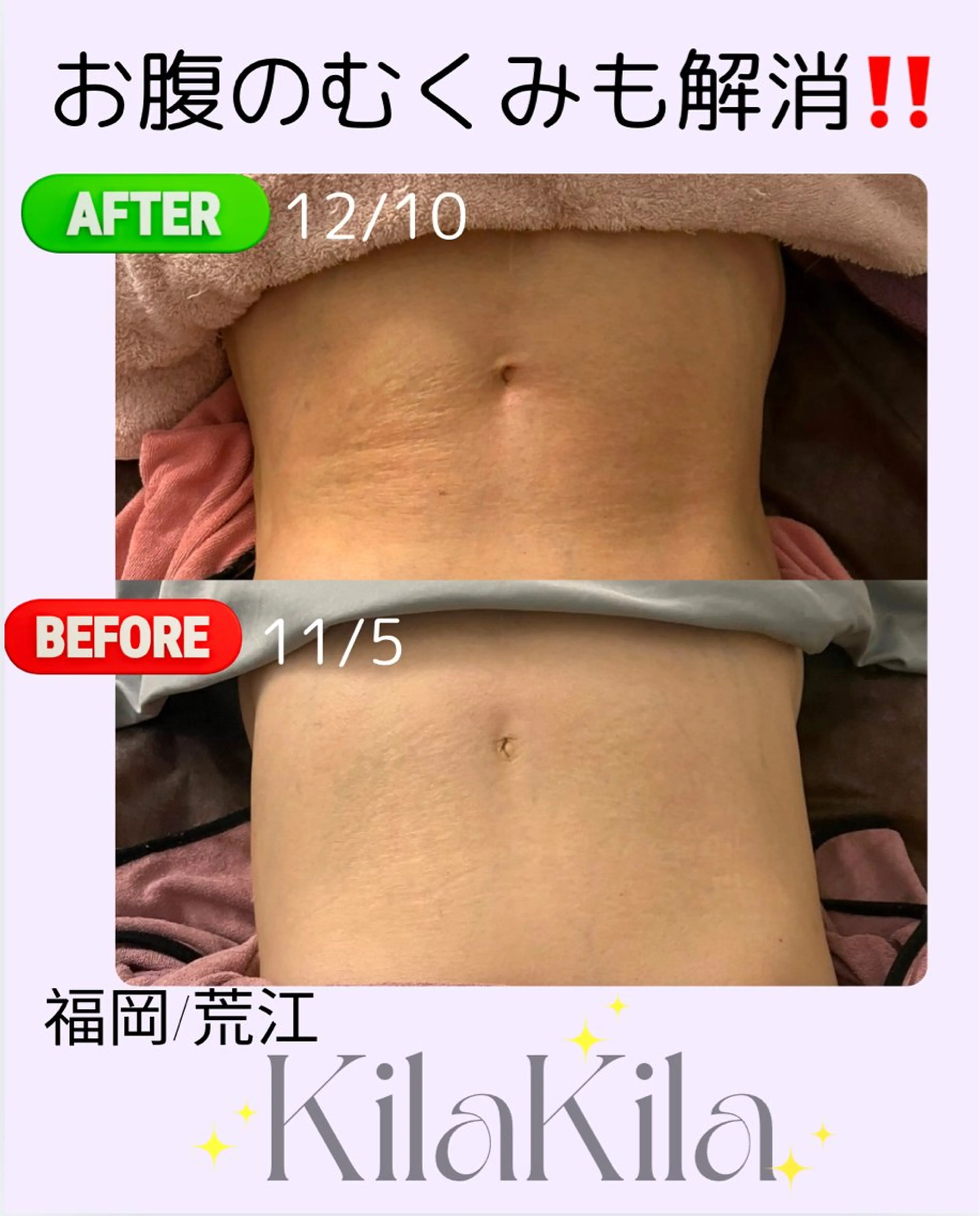 ドライヘッドスパ KilaKilaのエステ・リラクイメージ