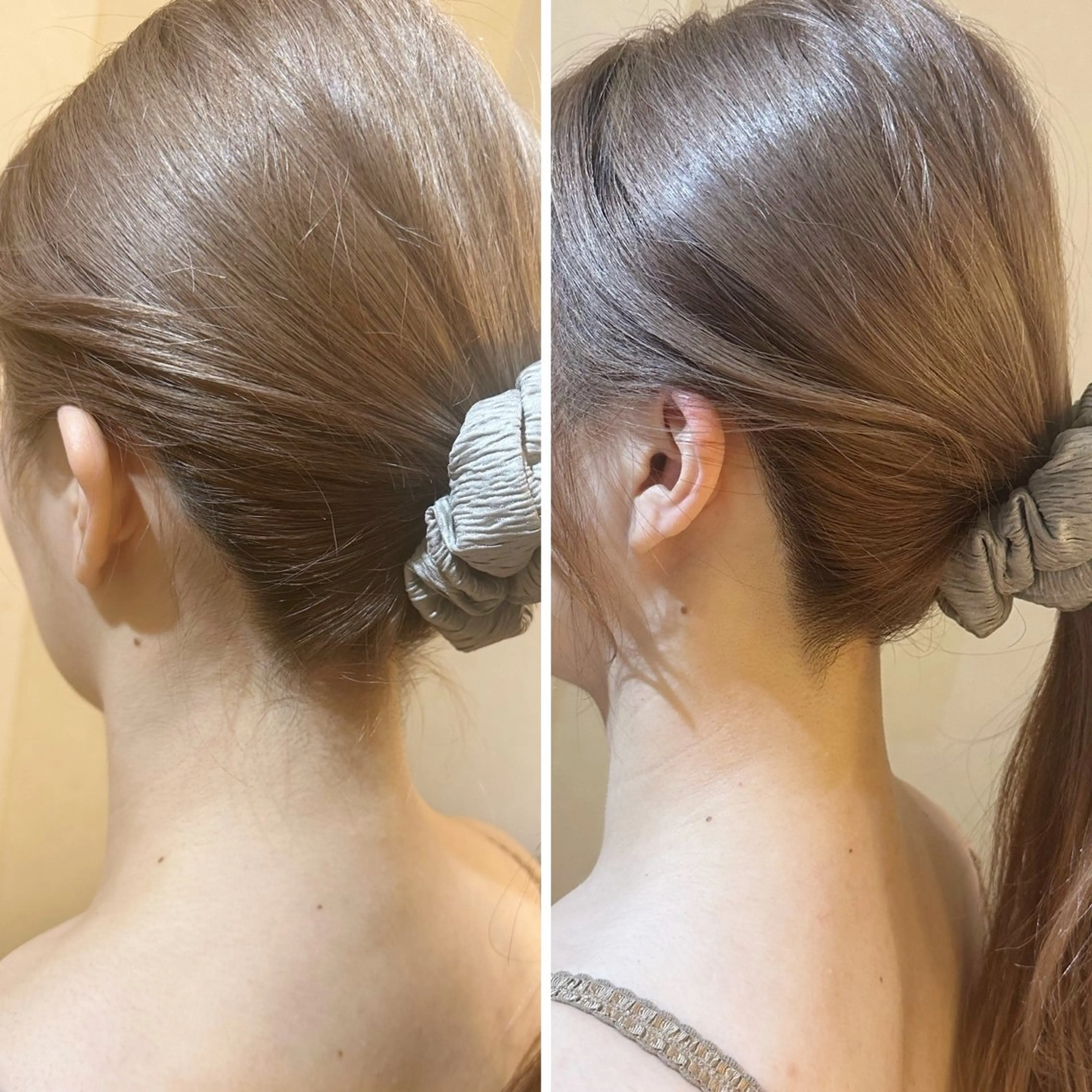 脱毛 うなじ脱毛/美肌脱毛 LABELのエステ・リラクイメージ