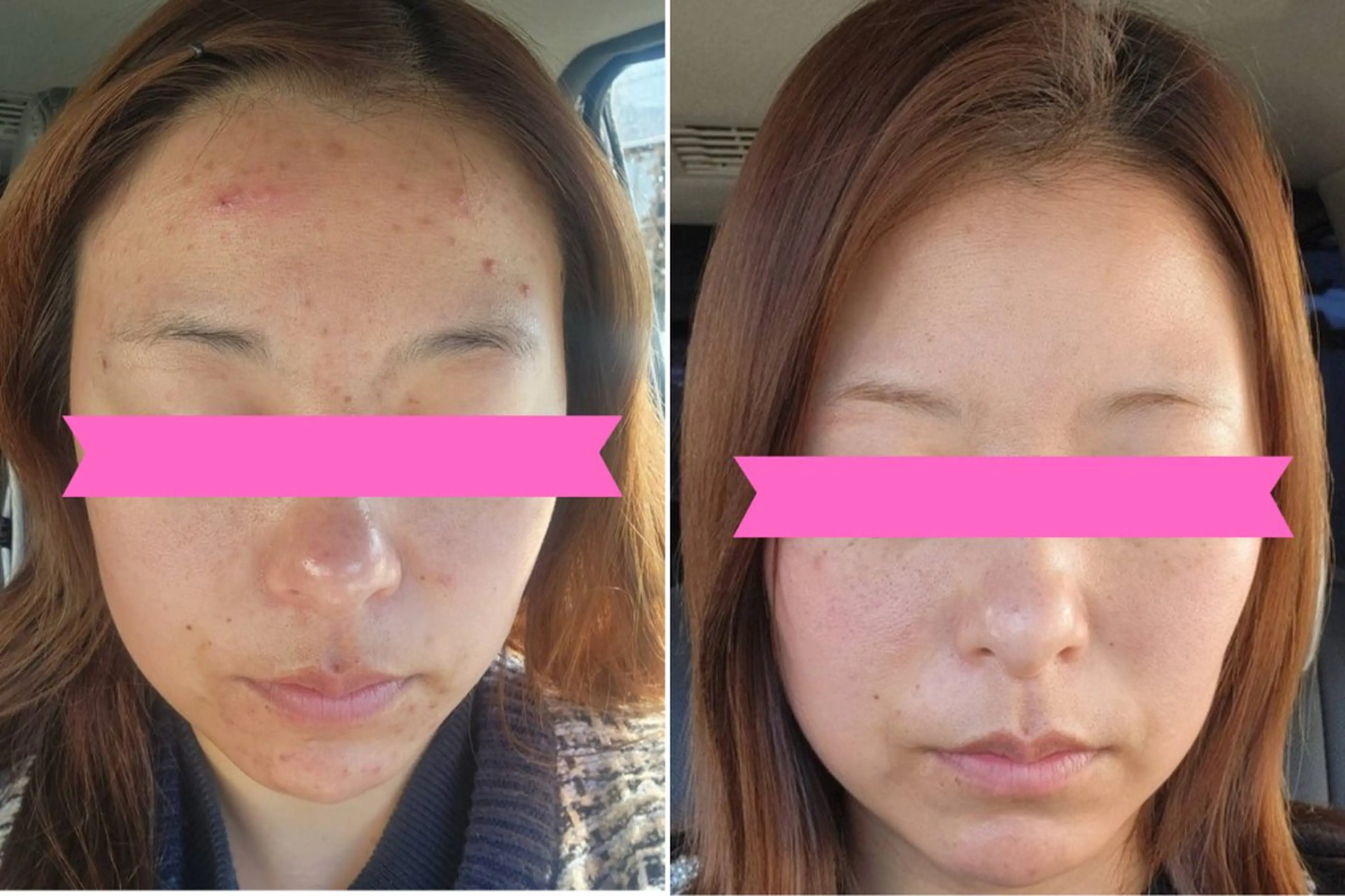 メディカルビューティーSalon Links所属・稲木 俊子のエステ・リラクイメージ