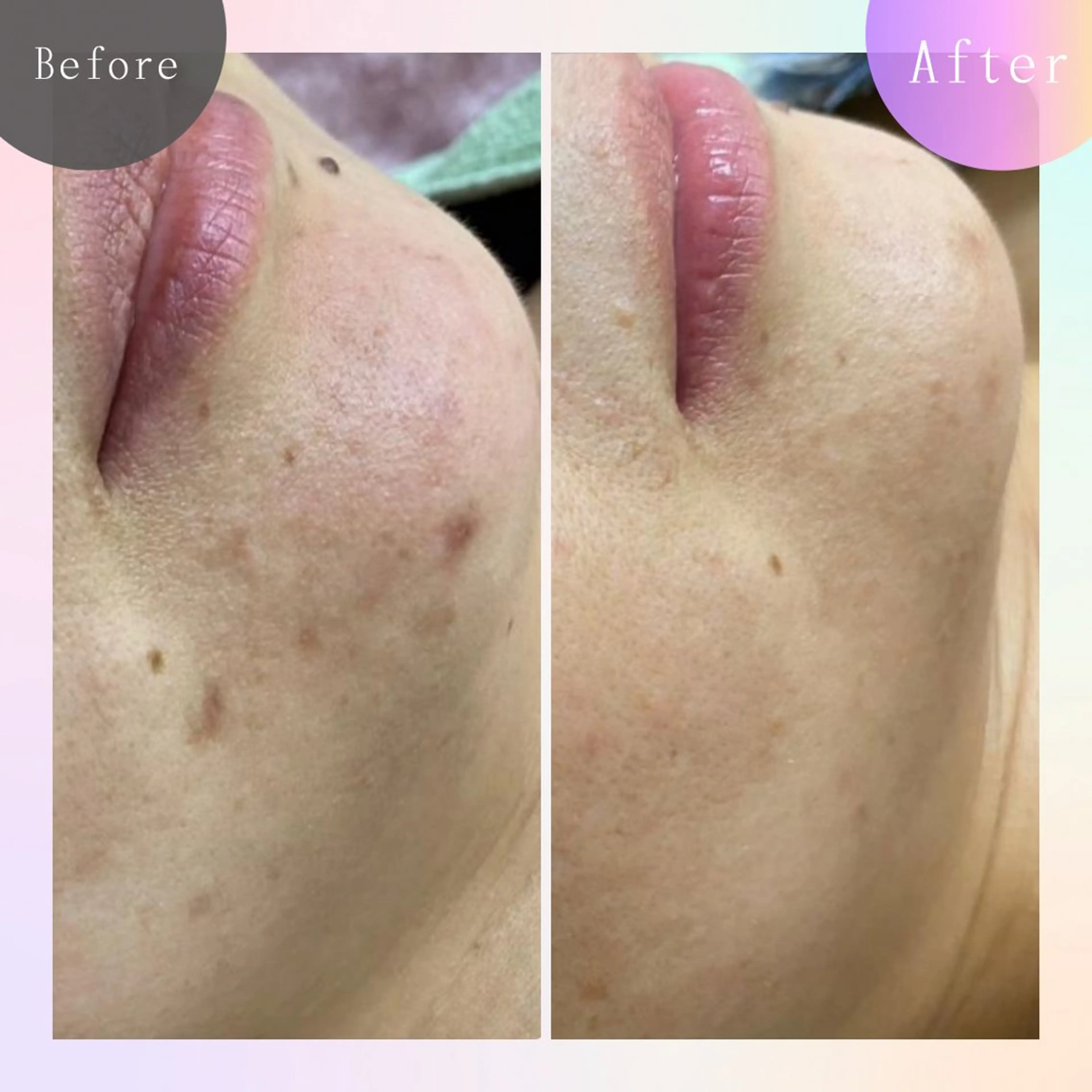 毛穴改善サロン d'Alba大阪住吉のエステ・リラクイメージ