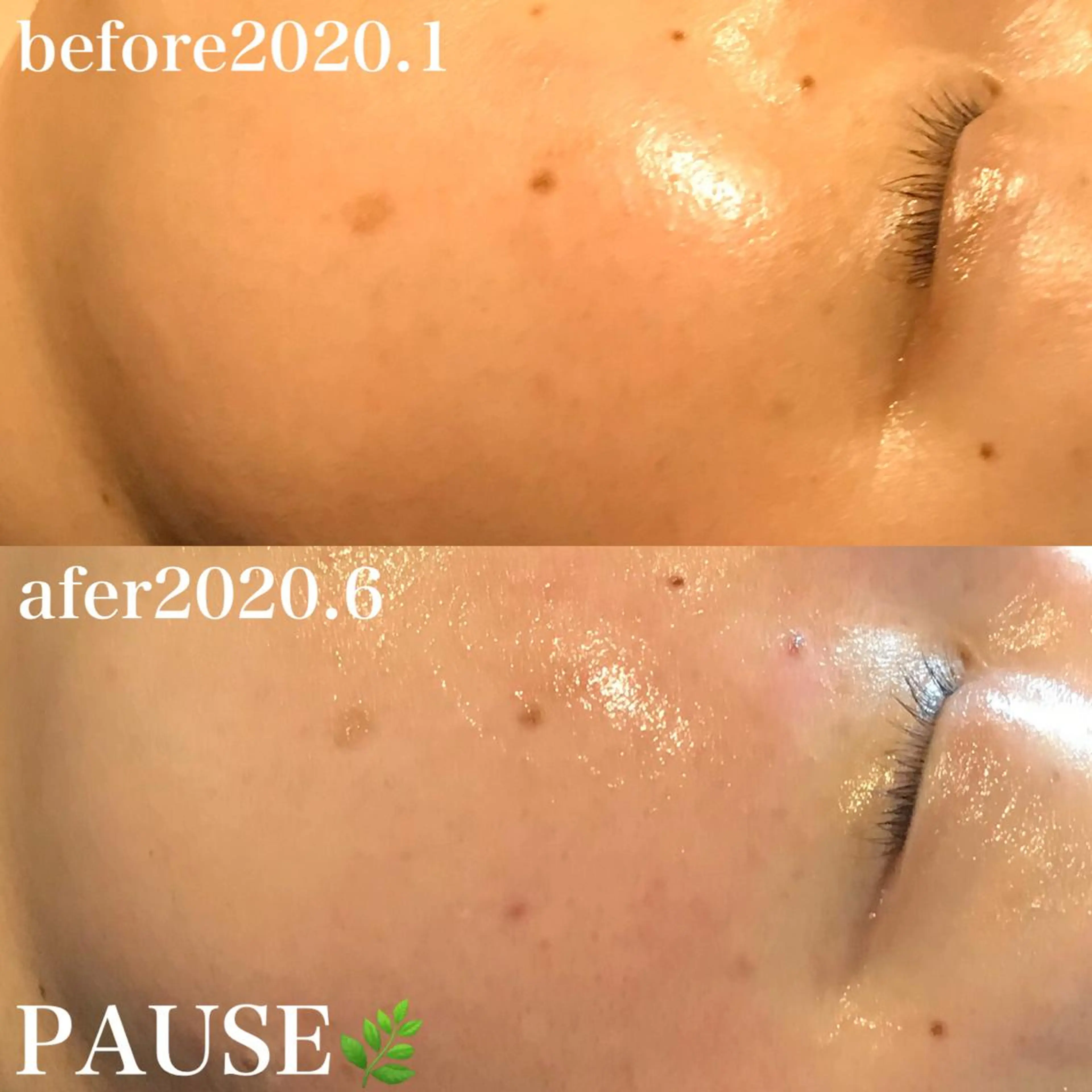 エステ 浜野 恵美のエステ・リラクイメージ