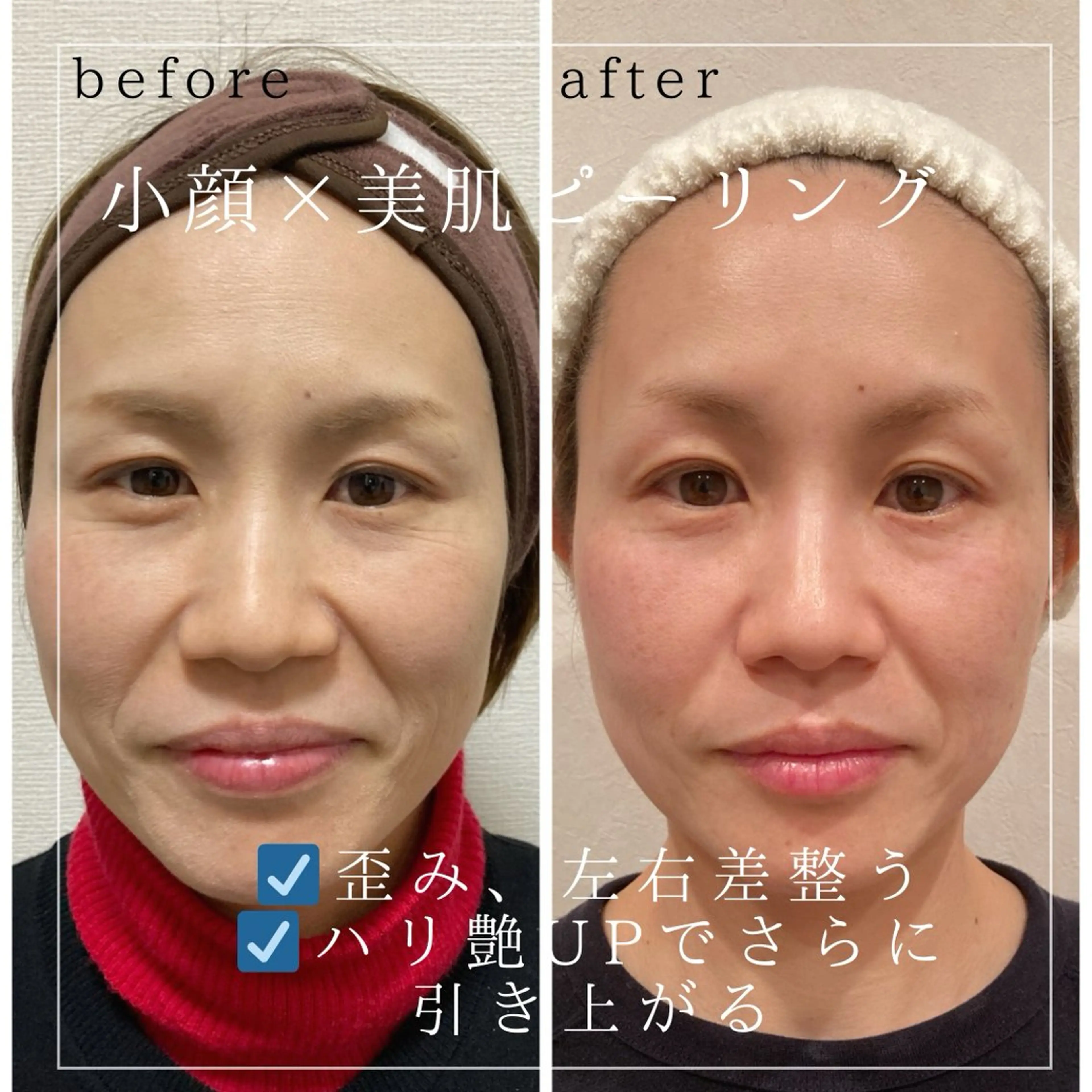 小顔×肌質改善サロン soin〔ソワン〕のエステ・リラクイメージ