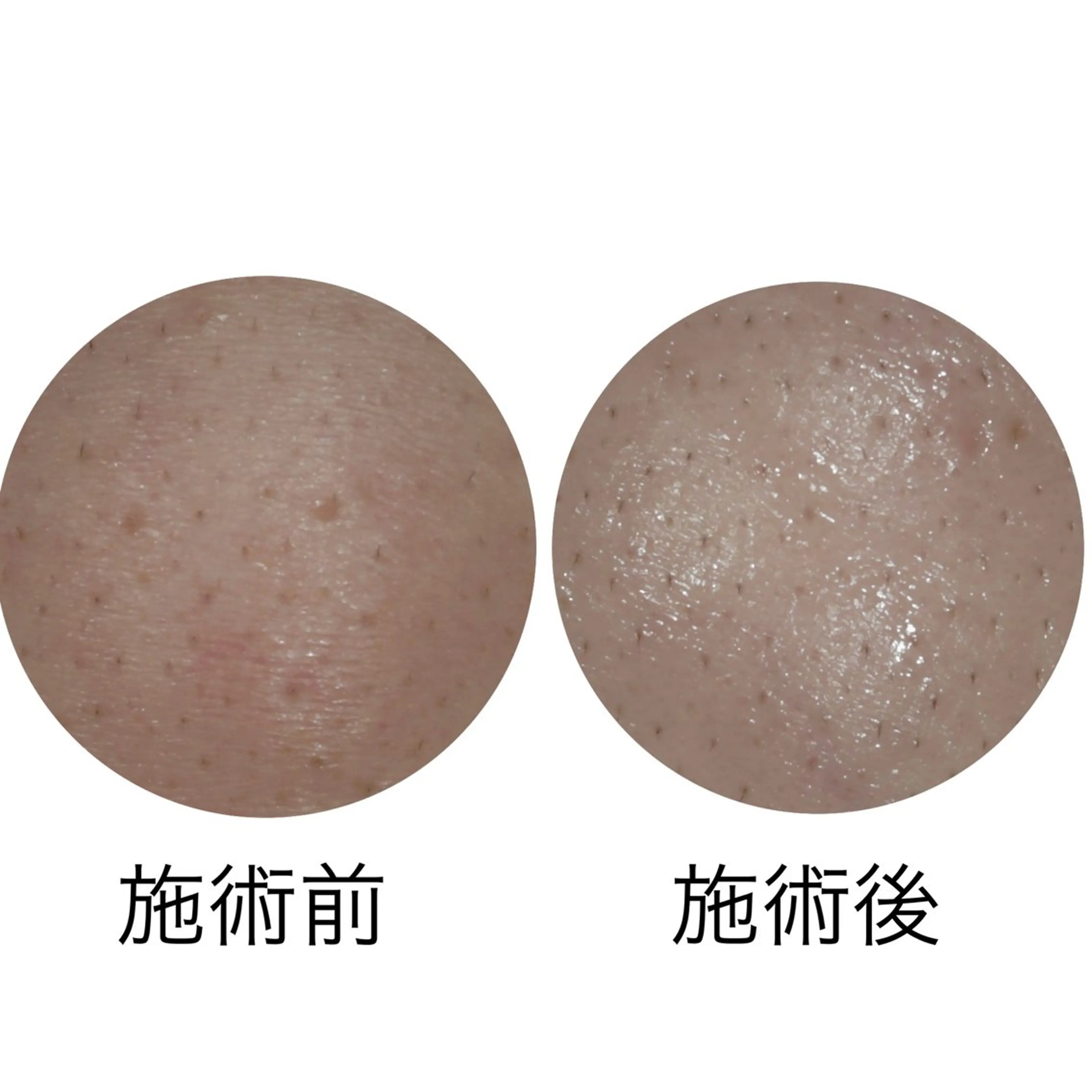 メナード丸の内ヒルズ 柳田りさのエステ・リラクイメージ