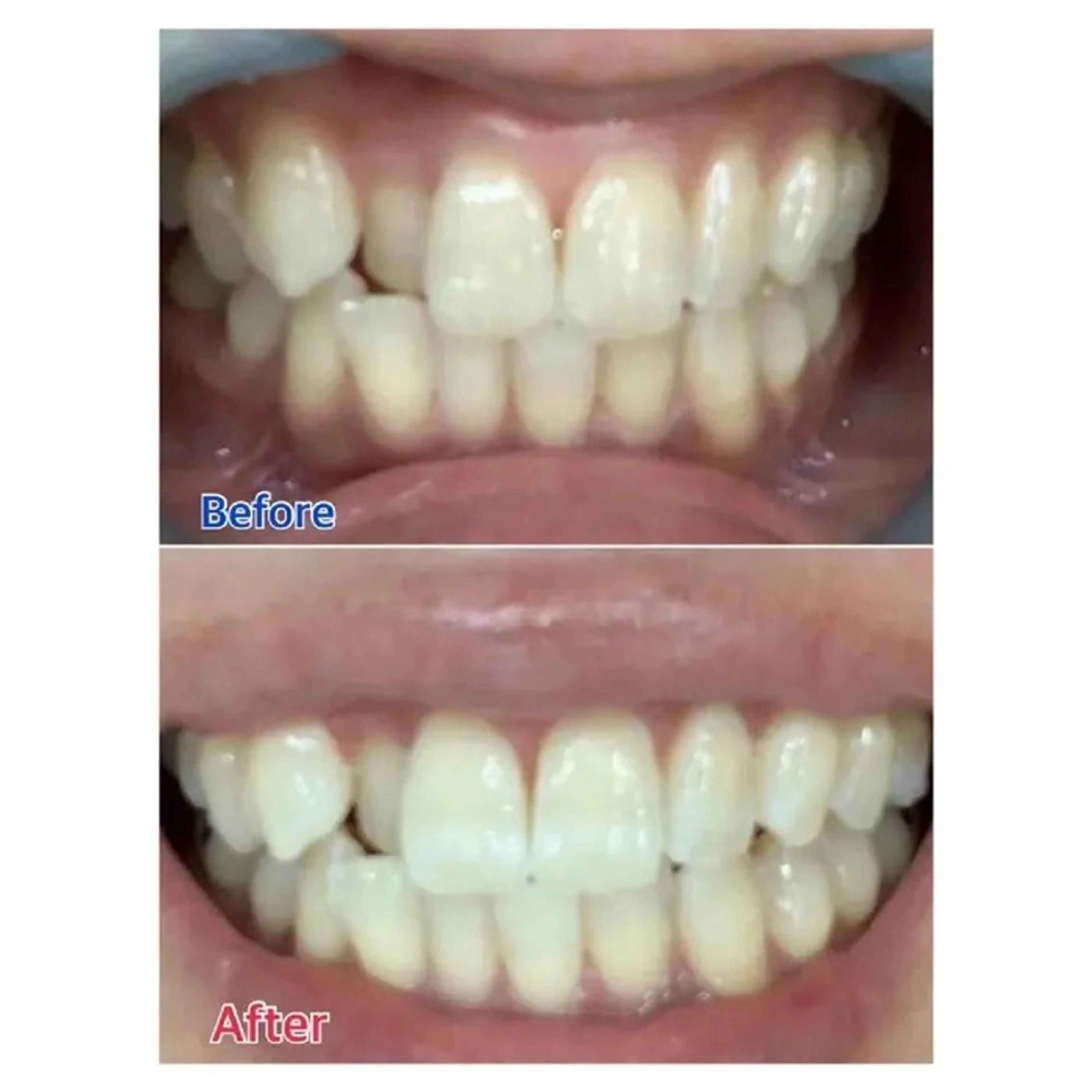 M渋谷 ホワイトニングのその他イメージ