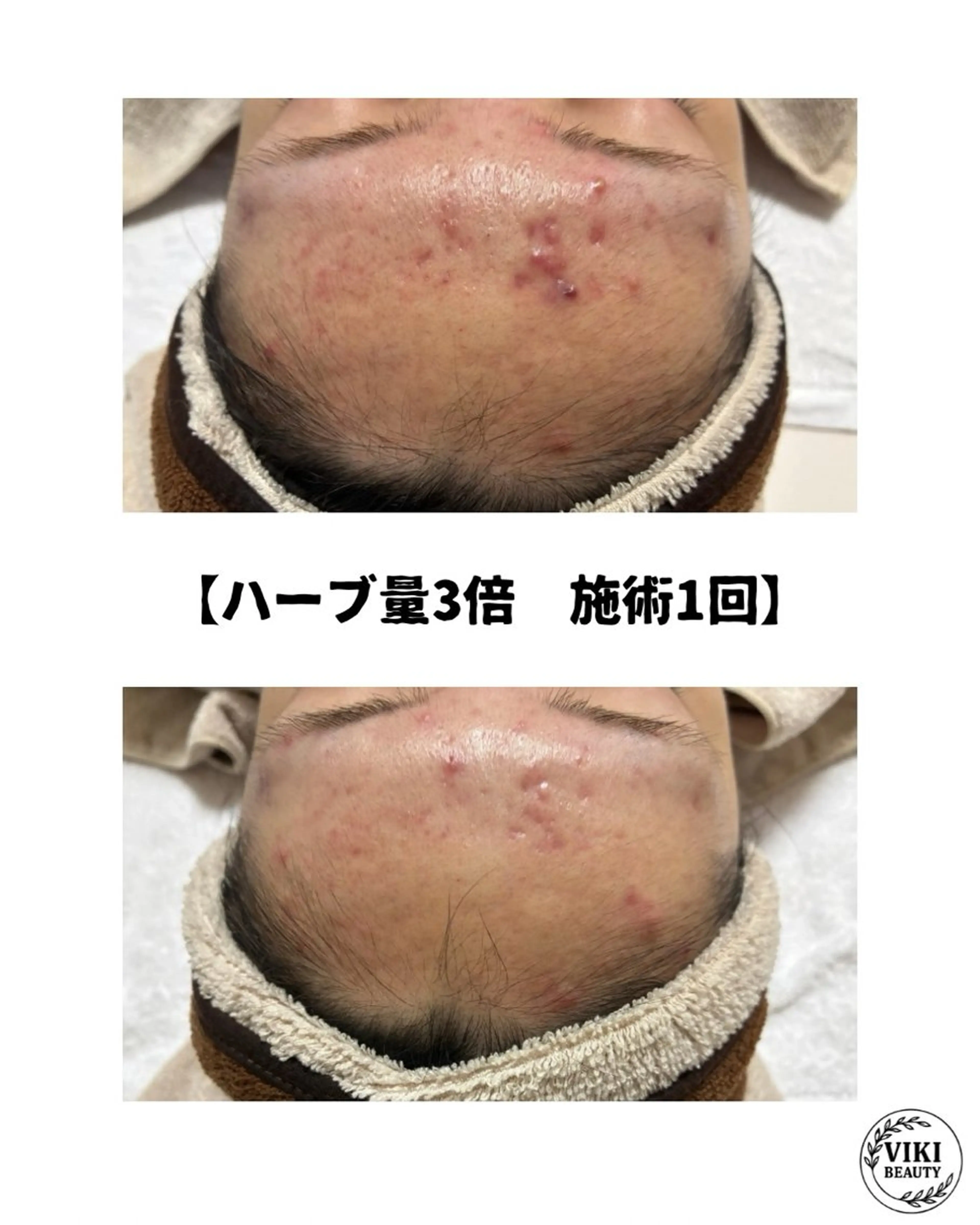 VIKI BEAUTYのエステ・リラクイメージ