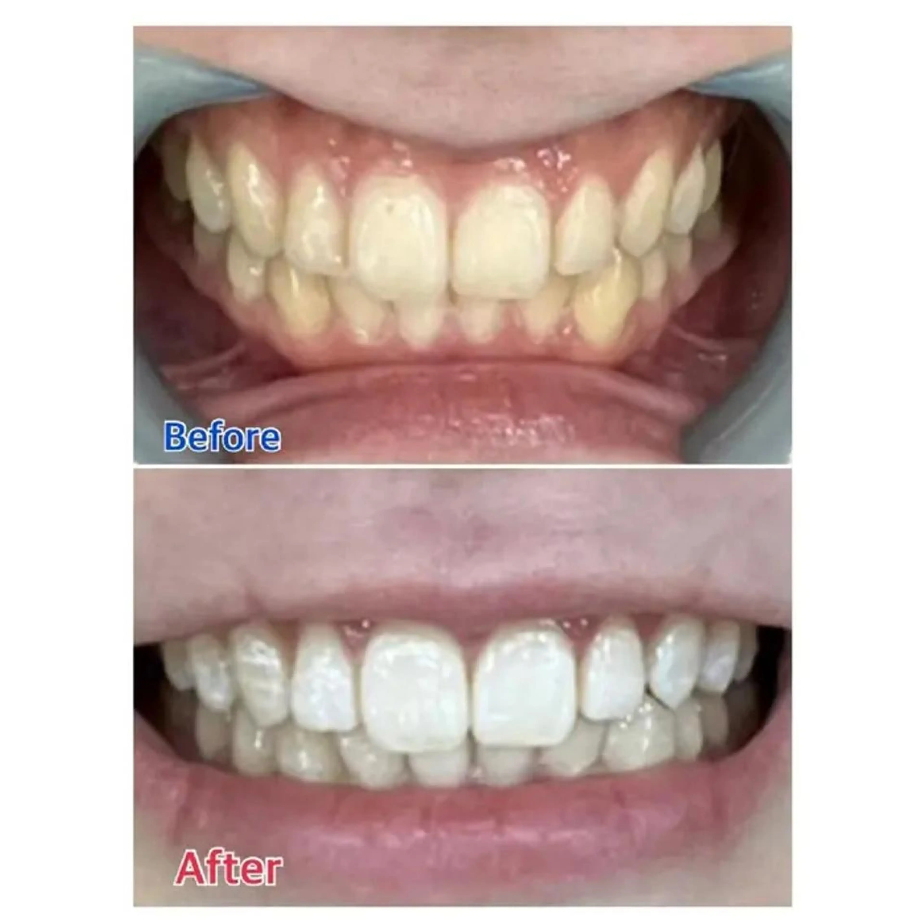 Ｍ渋谷 ホワイトニングのエステ・リラクイメージ