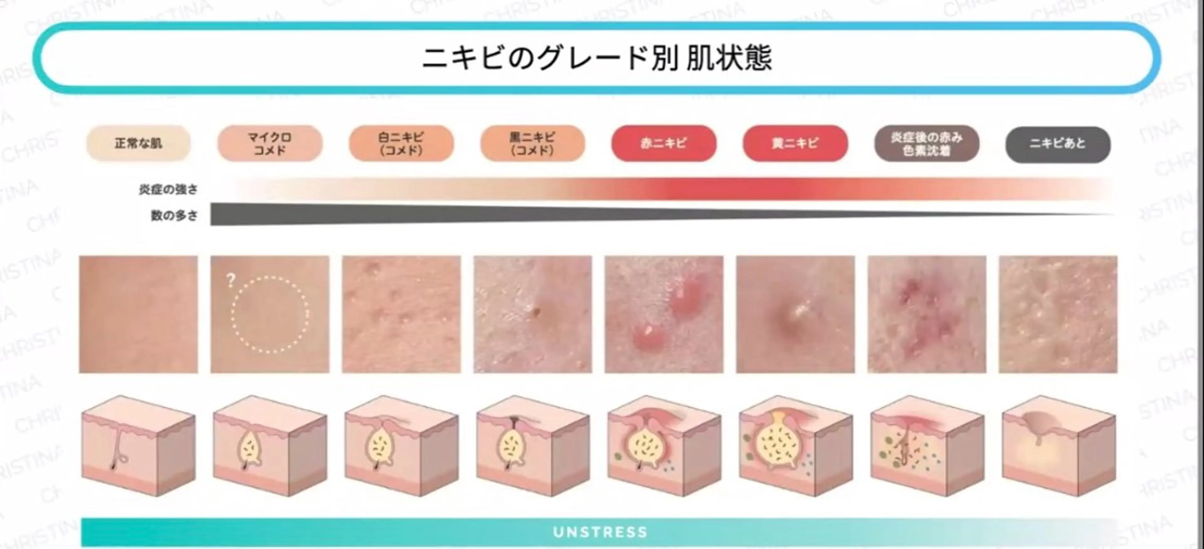 エステ les SALON所属・美肌脱毛/慢性疲労 /肩こり/むくみのエステ・リラクイメージ